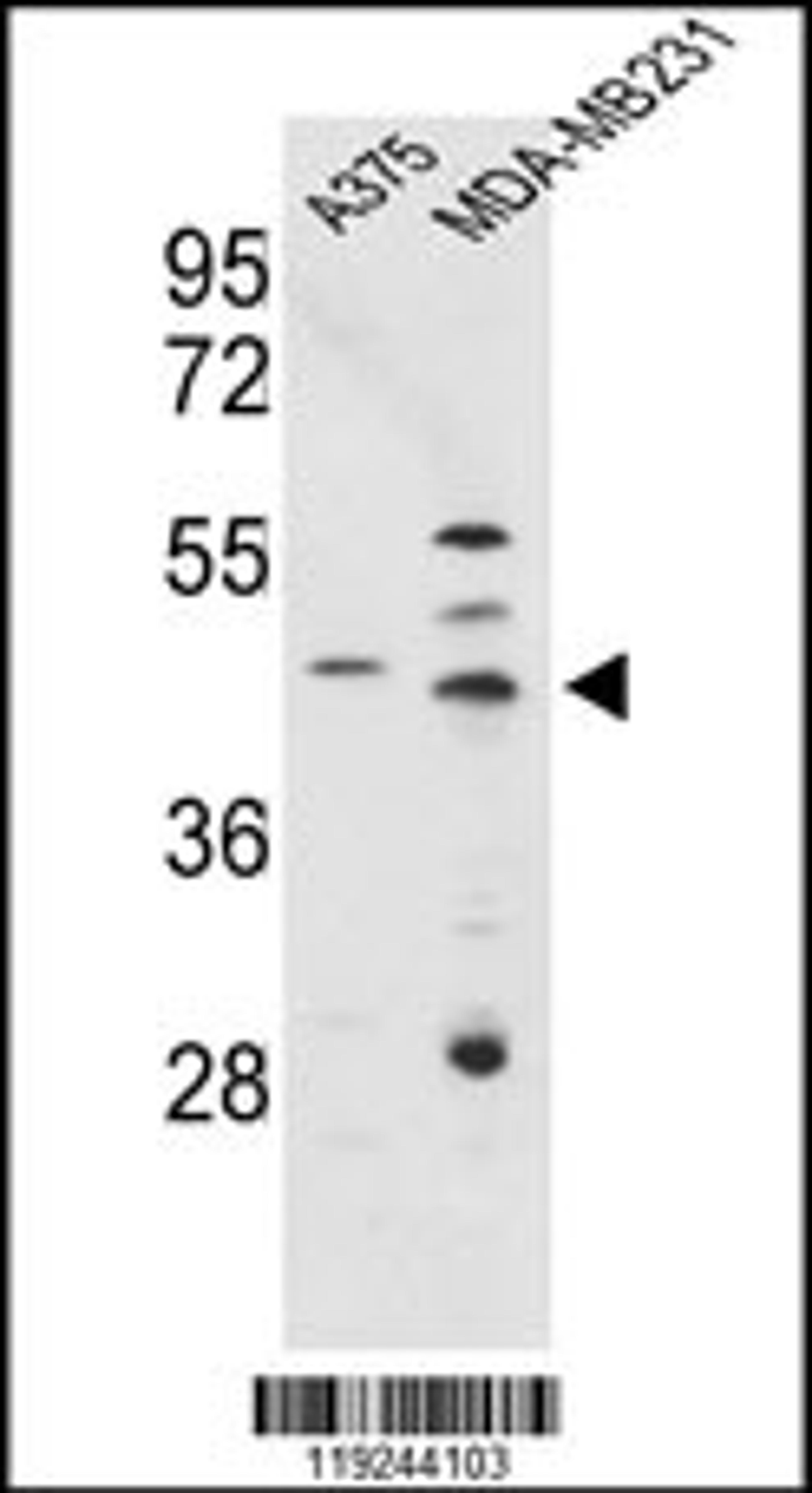 Western blot analysis of CTSD Antibody in A375, MDA-MB231 cell line lysates (35ug/lane)