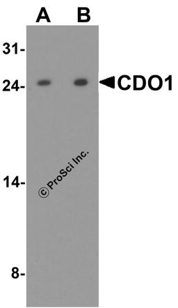 Western blot analysis of CDO1 in rat liver tissue lysate with CDO1 antibody at (A) 1 and (B) 2 μg/ml.