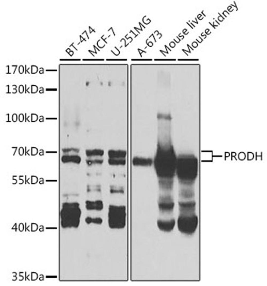 Western blot - PRODH antibody (A5836)