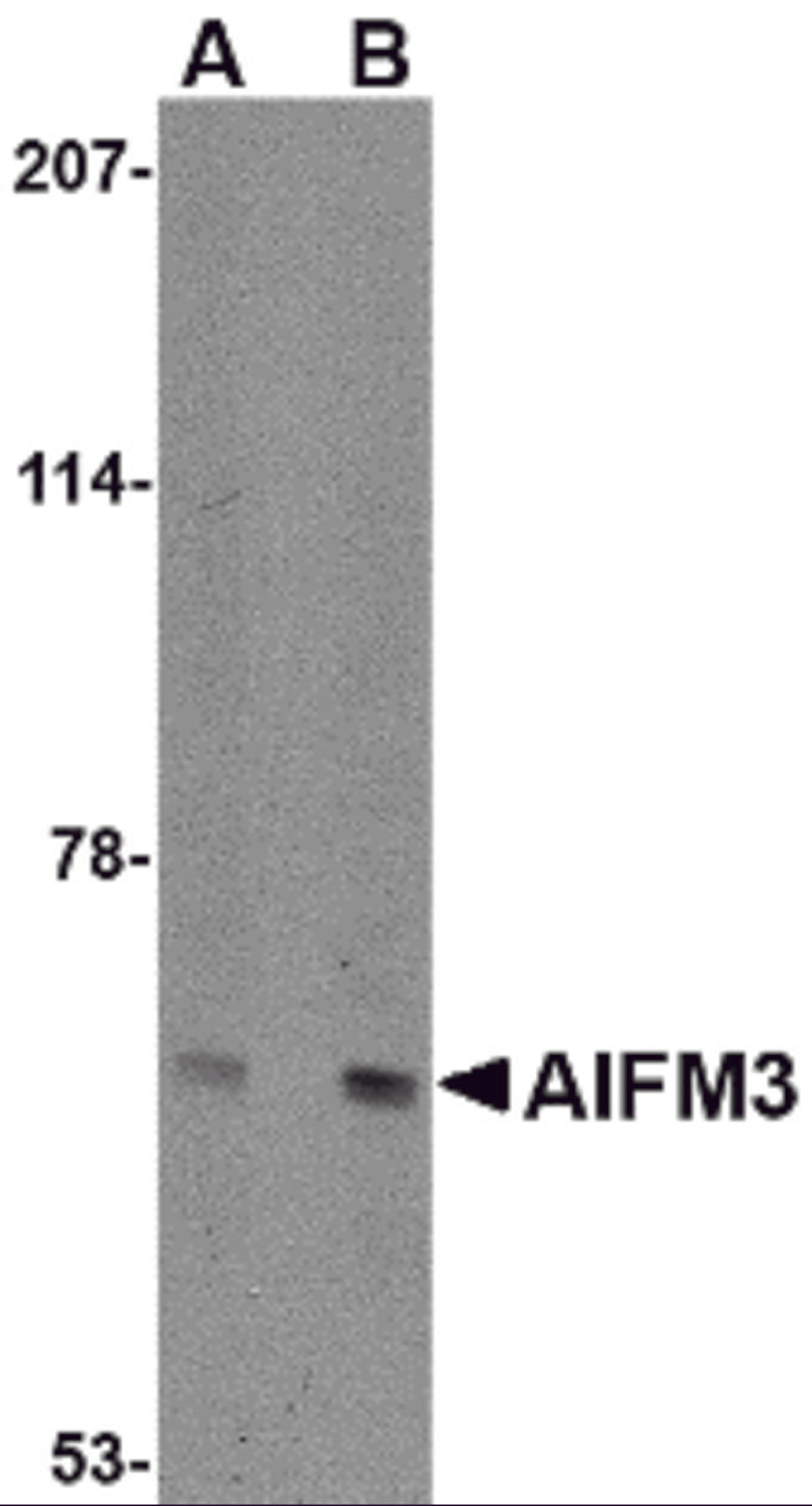 Western blot analysis of NIPSNAP in human brain tissue lysate with NIPSNAP antibody at (A) 0.5 and (B) 1 &#956;g/mL.