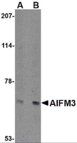 Western blot analysis of NIPSNAP in human brain tissue lysate with NIPSNAP antibody at (A) 0.5 and (B) 1 μg/mL.