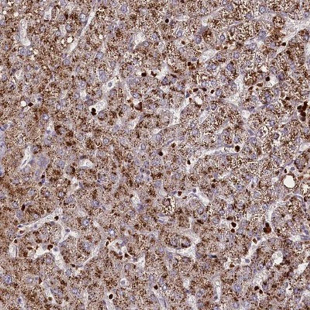 Immunohistochemistry-Paraffin: SUSD3 Antibody [NBP1-82723] - Immunohistochemical staining of human liver shows moderate granular cytoplasmic positivity in hepatocytes.