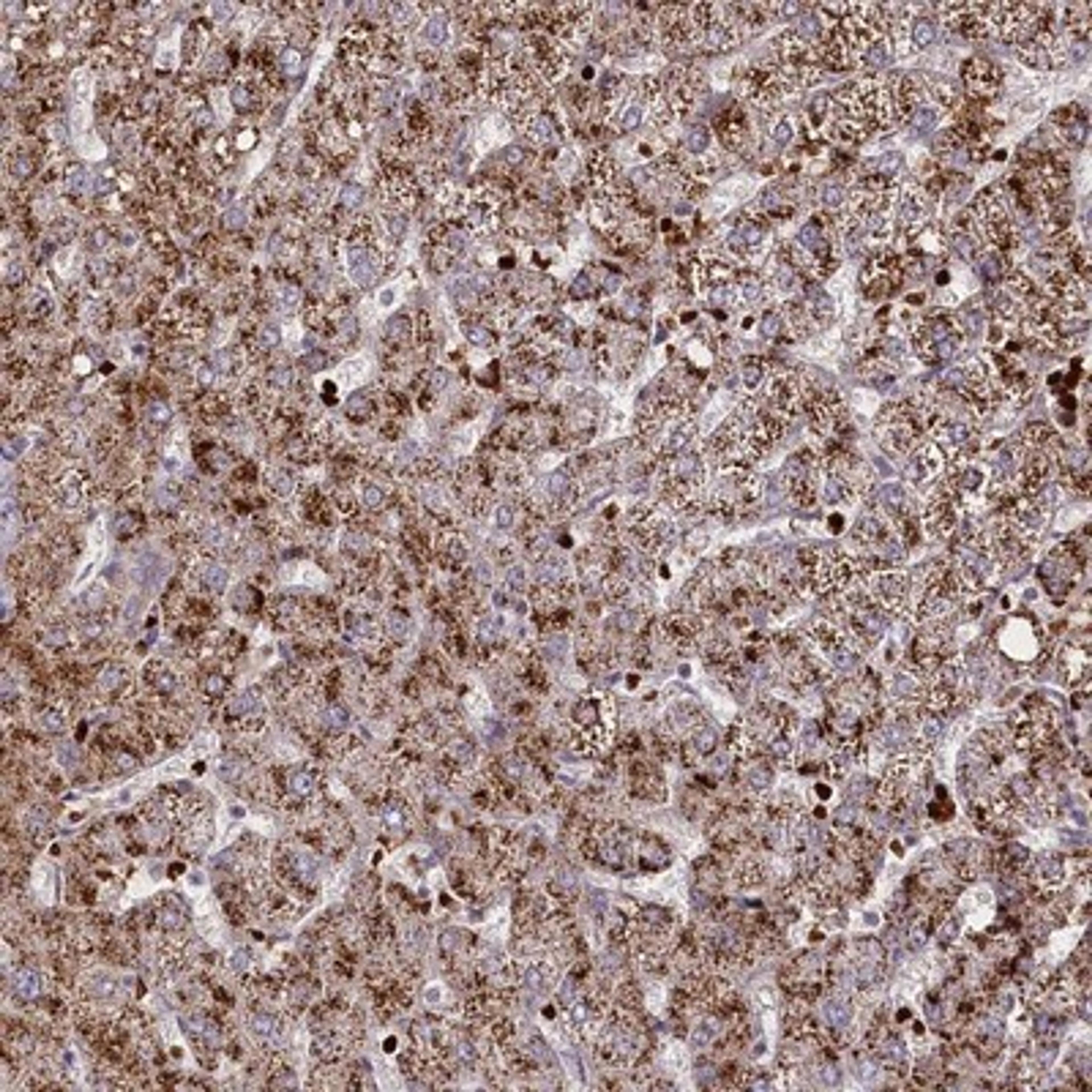 Immunohistochemistry-Paraffin: SUSD3 Antibody [NBP1-82723] - Immunohistochemical staining of human liver shows moderate granular cytoplasmic positivity in hepatocytes.