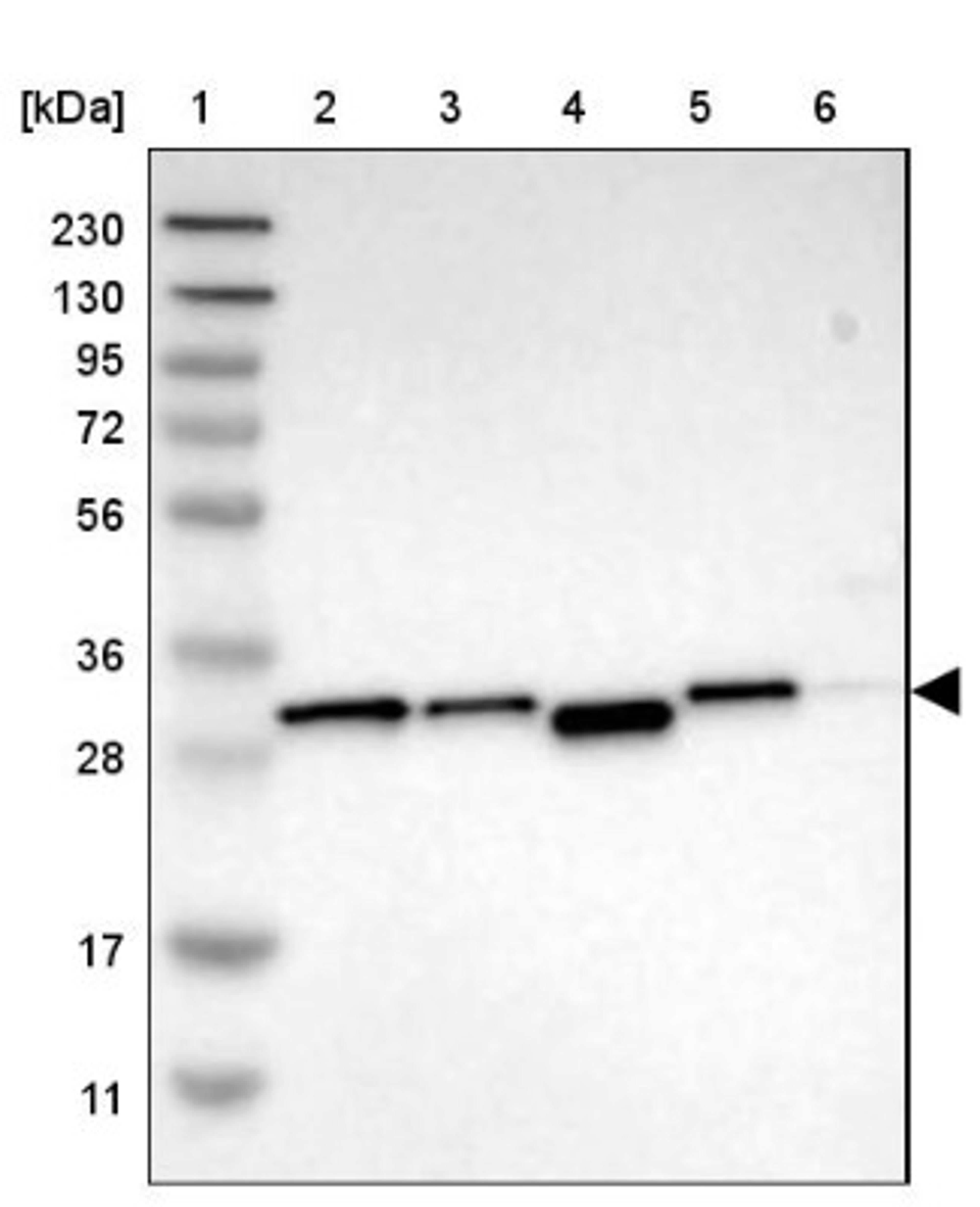 Western Blot: ENT2 Antibody [NBP1-85253] - Lane 1: Marker [kDa] 230, 130, 95, 72, 56, 36, 28, 17, 11<br/>Lane 2: Human cell line RT-4<br/>Lane 3: Human cell line U-251MG sp<br/>Lane 4: Human plasma (IgG/HSA depleted)<br/>Lane 5: Human liver tissue<br/>Lane 6: Human tonsil tissue