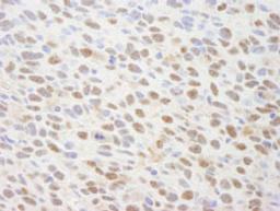 Detection of mouse TRIP1/SUG1 by immunohistochemistry.