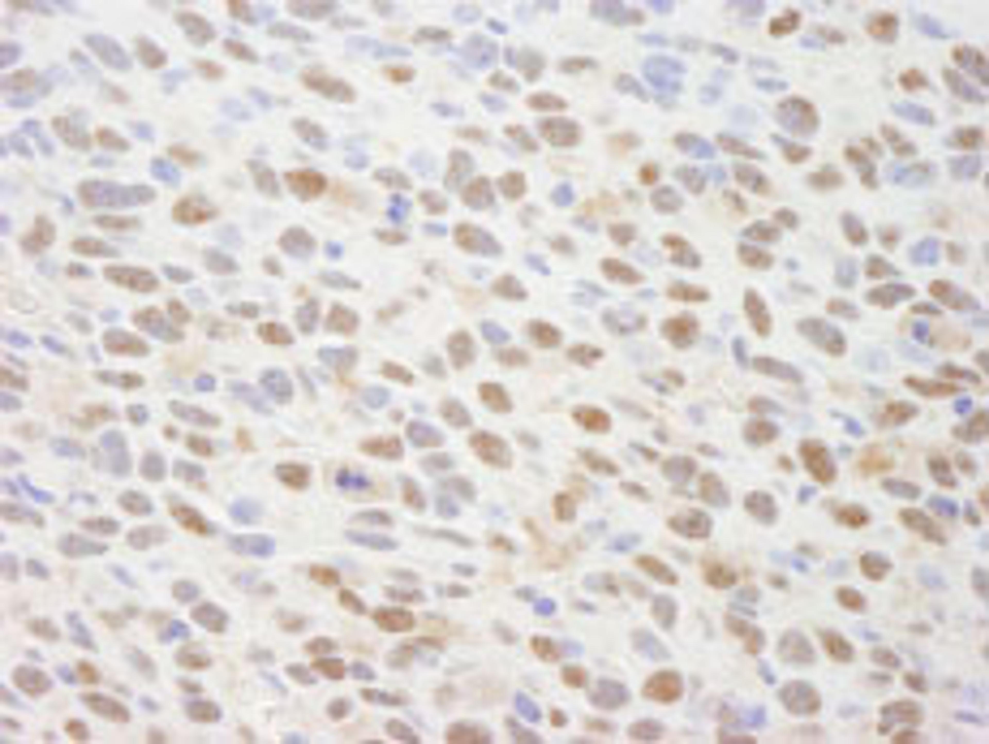 Detection of mouse TRIP1/SUG1 by immunohistochemistry.