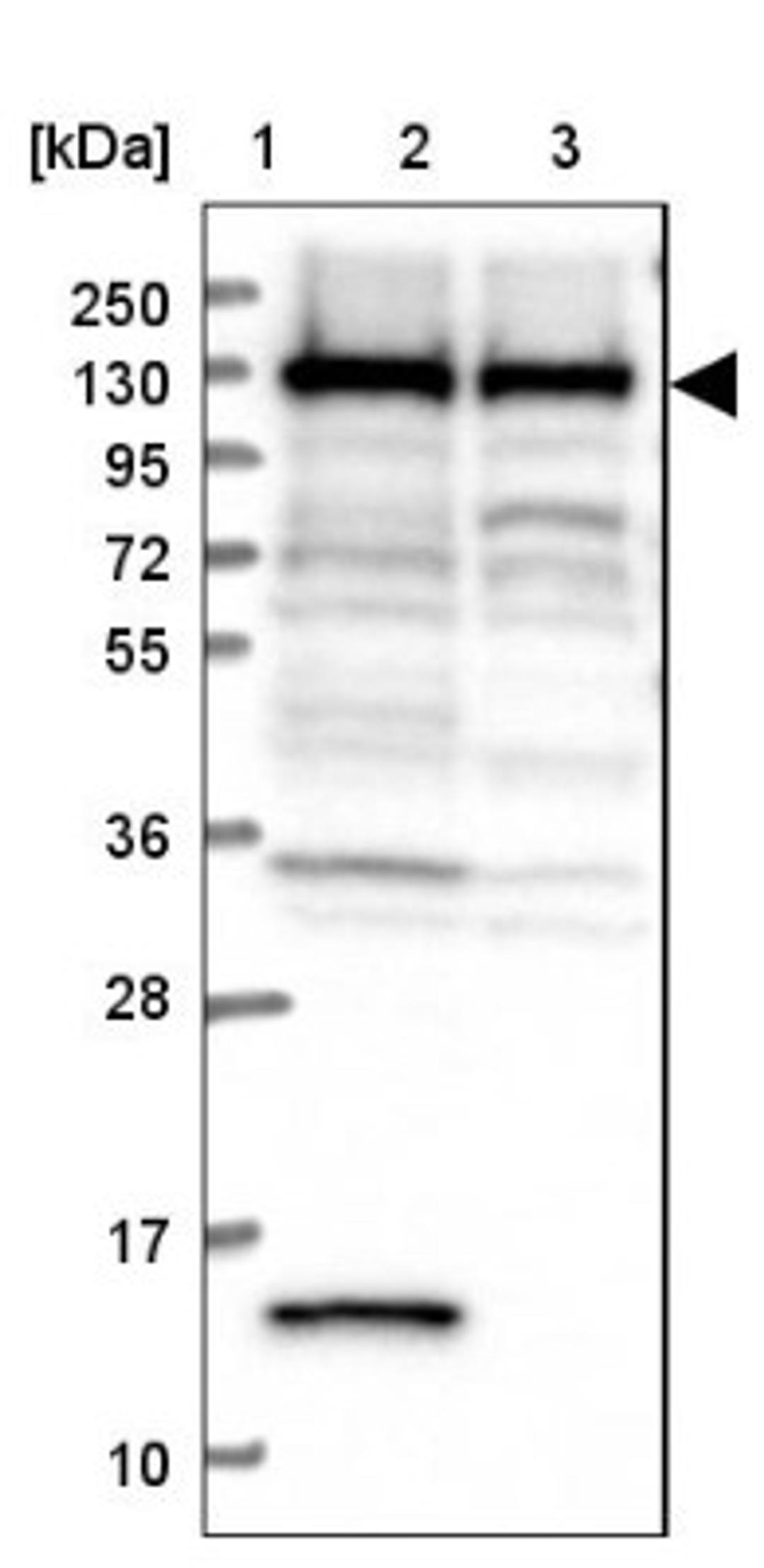 Western Blot: PPP4R1 Antibody [NBP1-87241] - Lane 1: Marker [kDa] 250, 130, 95, 72, 55, 36, 28, 17, 10<br/>Lane 2: Human cell line RT-4<br/>Lane 3: Human cell line U-251MG sp