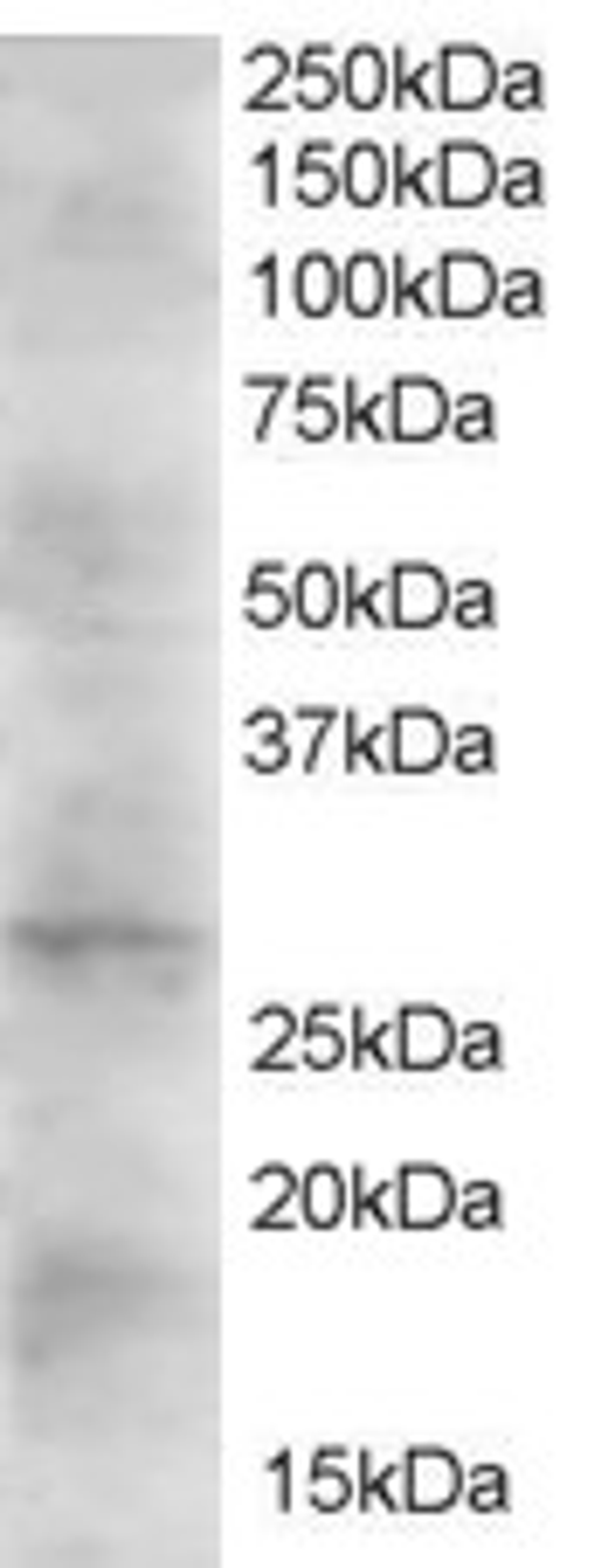 45-484 (2ug/ml) staining of Human Heart lysate (35ug protein in RIPA buffer). Primary incubation was 1 hour. Detected by chemiluminescence.