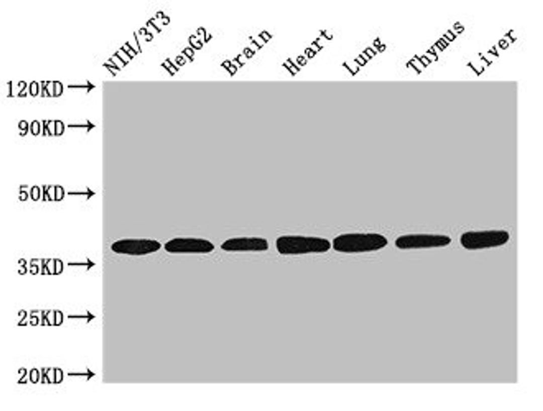 Western Blot. Positive WB detected in: NIH/3T3 whole cell lysate, HepG2 whole cell lysate, Mouse brain tissue, Mouse heart tissue, Mouse lung tissue, Mouse thymus tissue, Rat liver tissue. All lanes: LDHC antibody at 3.2ug/ml. Secondary. Goat polyclonal to rabbit IgG at 1/50000 dilution. Predicted band size: 37 kDa. Observed band size: 37 kDa. 
