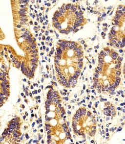 Immunohistochemical analysis of paraffin-embedded H. duodenum section using STRADA Antibody . Antibody was diluted at 1:100 dilution. A peroxidase-conjugated goat anti-rabbit IgG at 1:400 dilution was used as the secondary antibody, followed by DAB staini