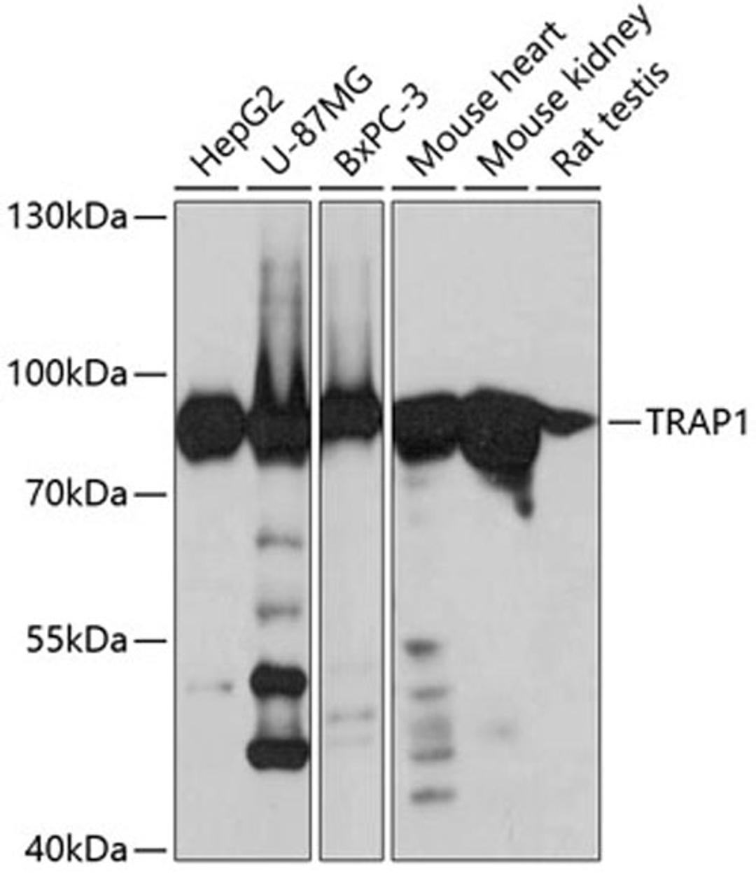 Western blot - TRAP1 antibody (A2748)