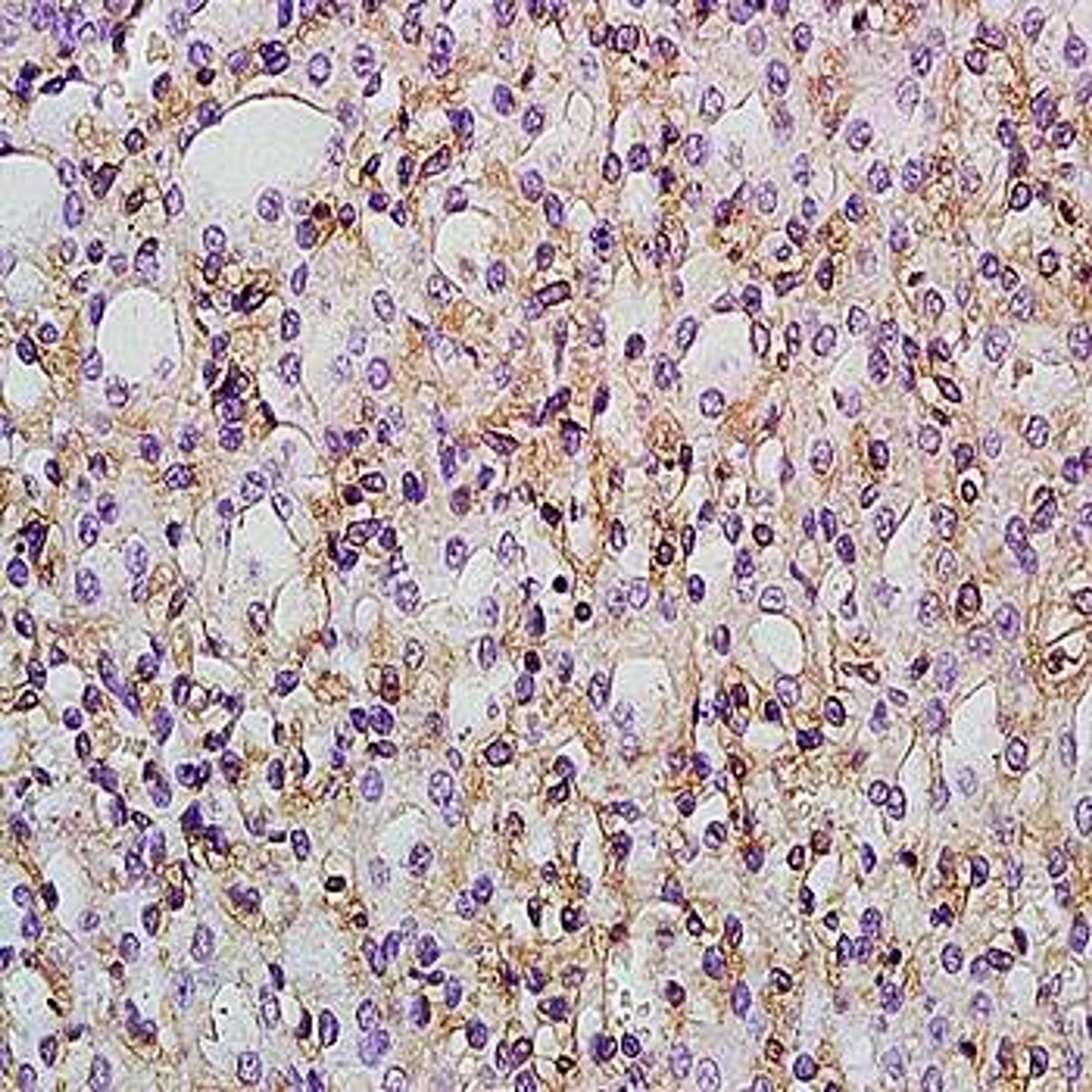 Immunohistochemical analysis of formalin-fixed and paraffin embedded rat kidney tissue (Dilution at:1:200) using PTGER1 antibody