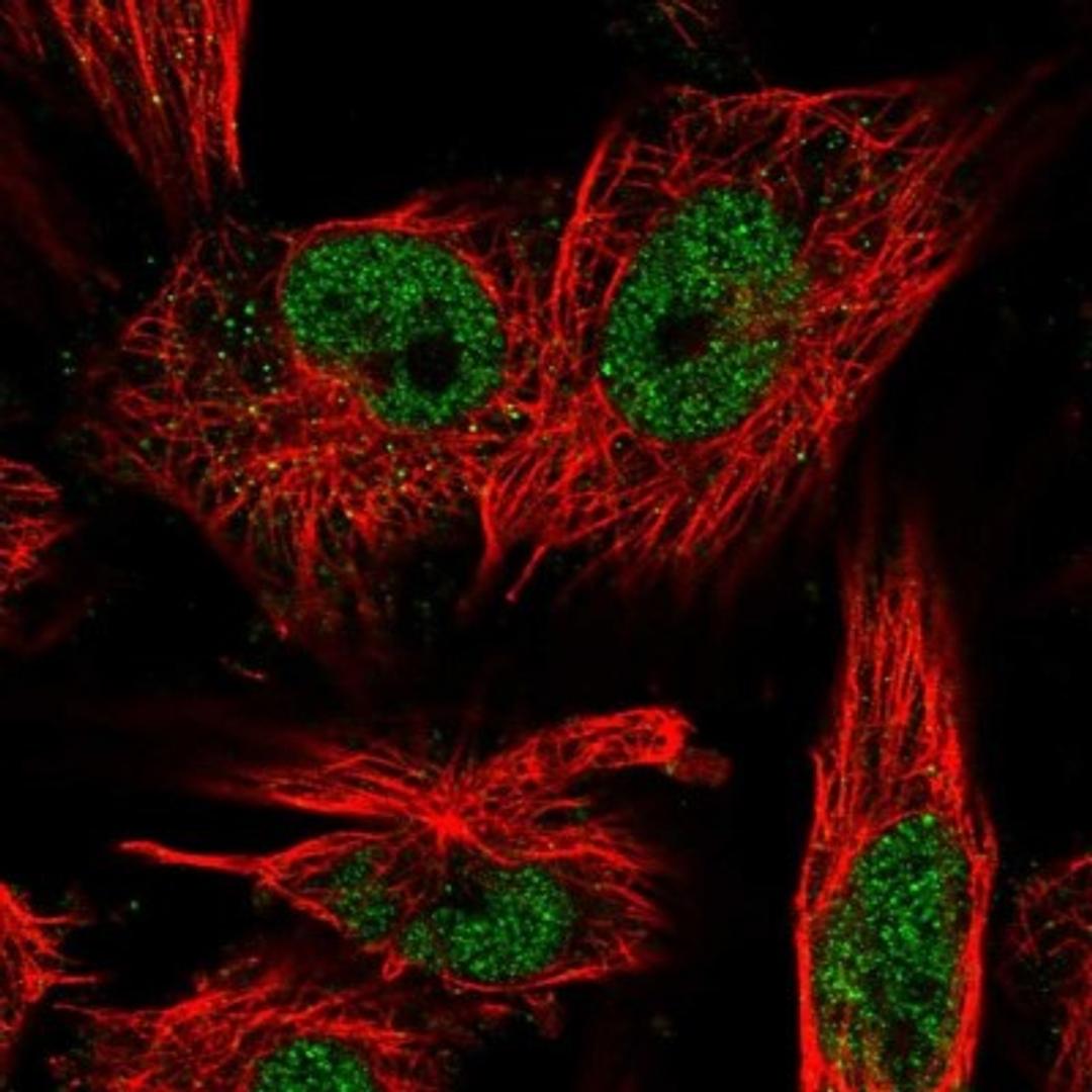 Immunocytochemistry/Immunofluorescence: LRP5L Antibody [NBP1-90543] - Staining of human cell line U-251 MG shows positivity in nucleus but not nucleoli.