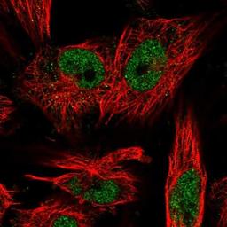 Immunocytochemistry/Immunofluorescence: LRP5L Antibody [NBP1-90543] - Staining of human cell line U-251 MG shows positivity in nucleus but not nucleoli.