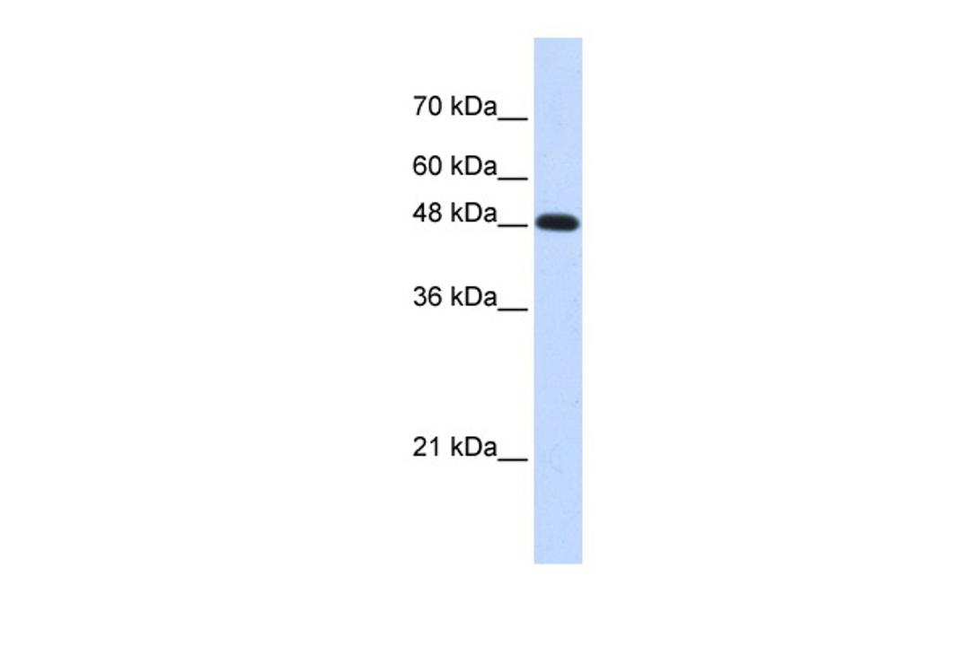 Antibody used in WB on Transfected 293T at 0.2-1 ug/ml.