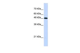 Antibody used in WB on Transfected 293T at 0.2-1 ug/ml.