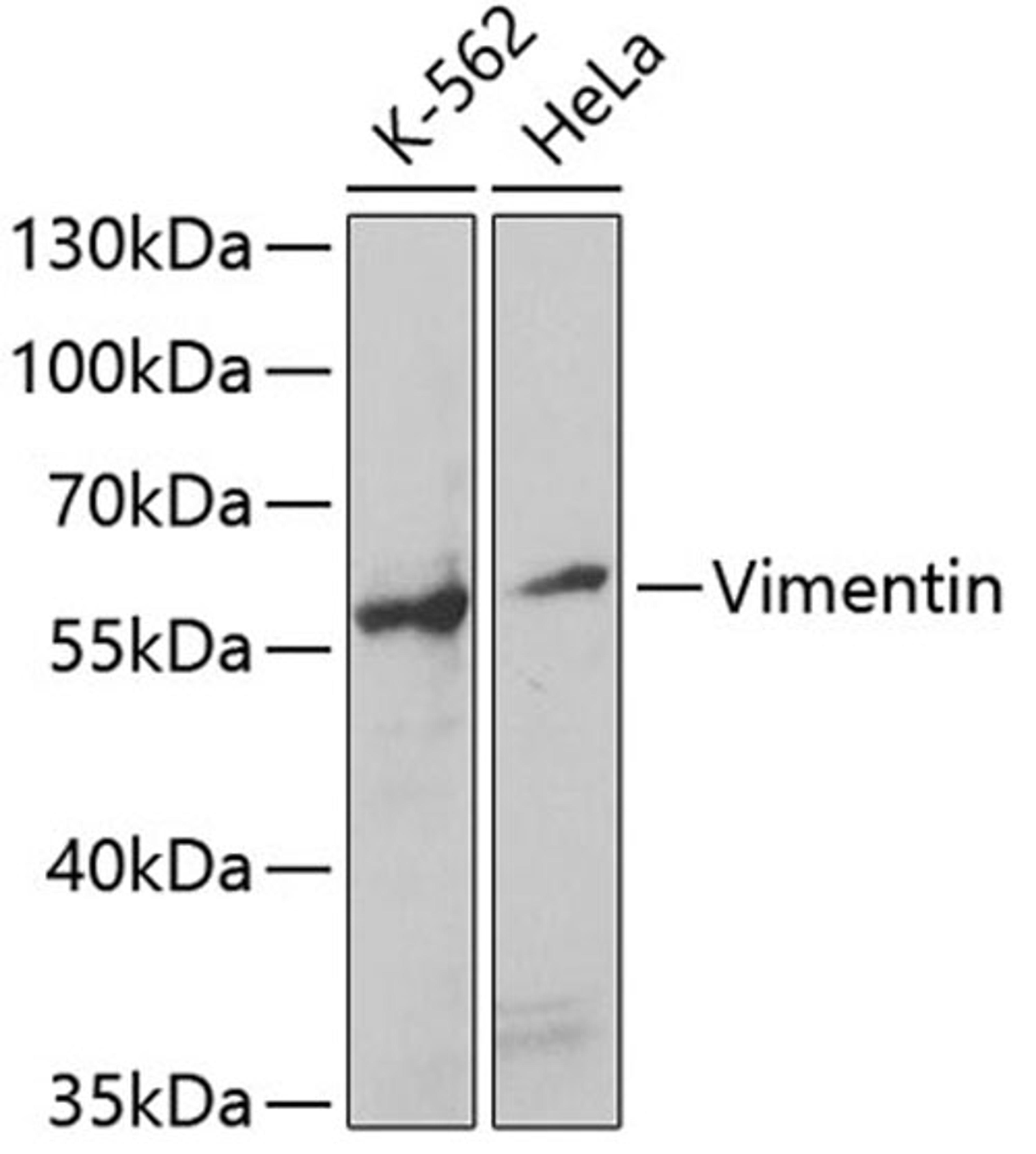 Western blot - Vimentin antibody (A2584)