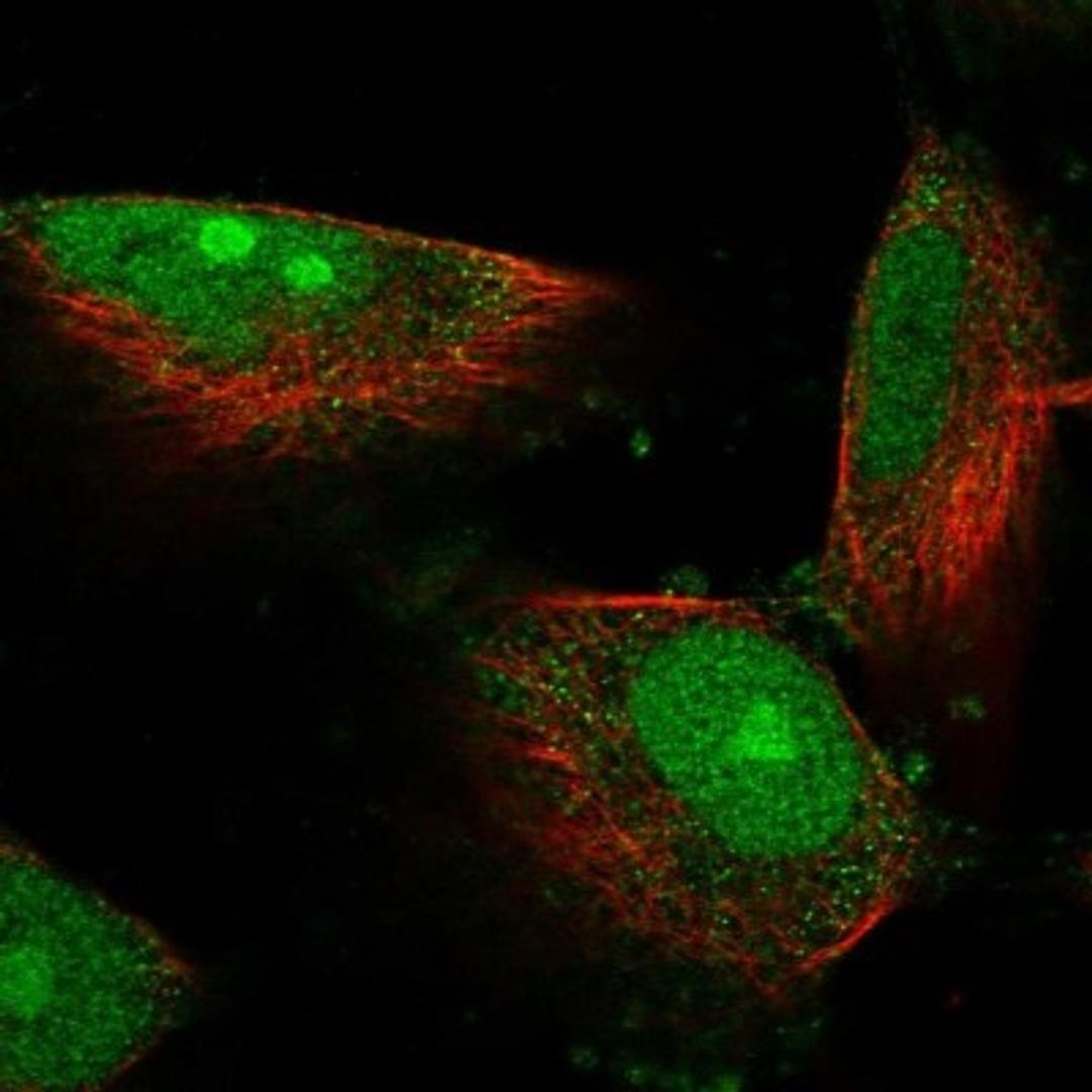 Immunofluorescence: DIMT1L Antibody [NBP2-30659] - Immunofluorescent staining of human cell line U-251 MG shows positivity in nucleus, nucleoli & cytoplasm.