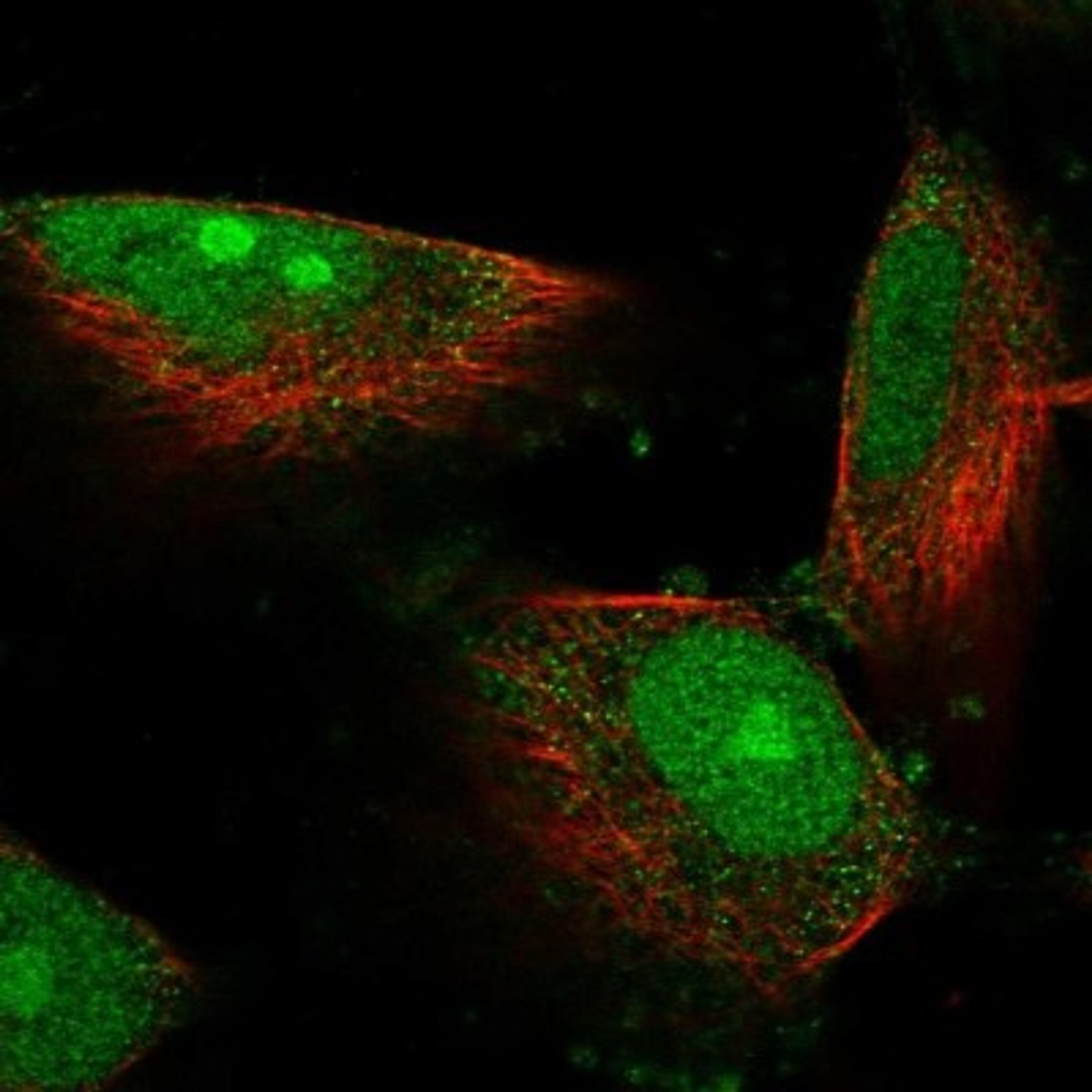 Immunofluorescence: DIMT1L Antibody [NBP2-30659] - Immunofluorescent staining of human cell line U-251 MG shows positivity in nucleus, nucleoli & cytoplasm.