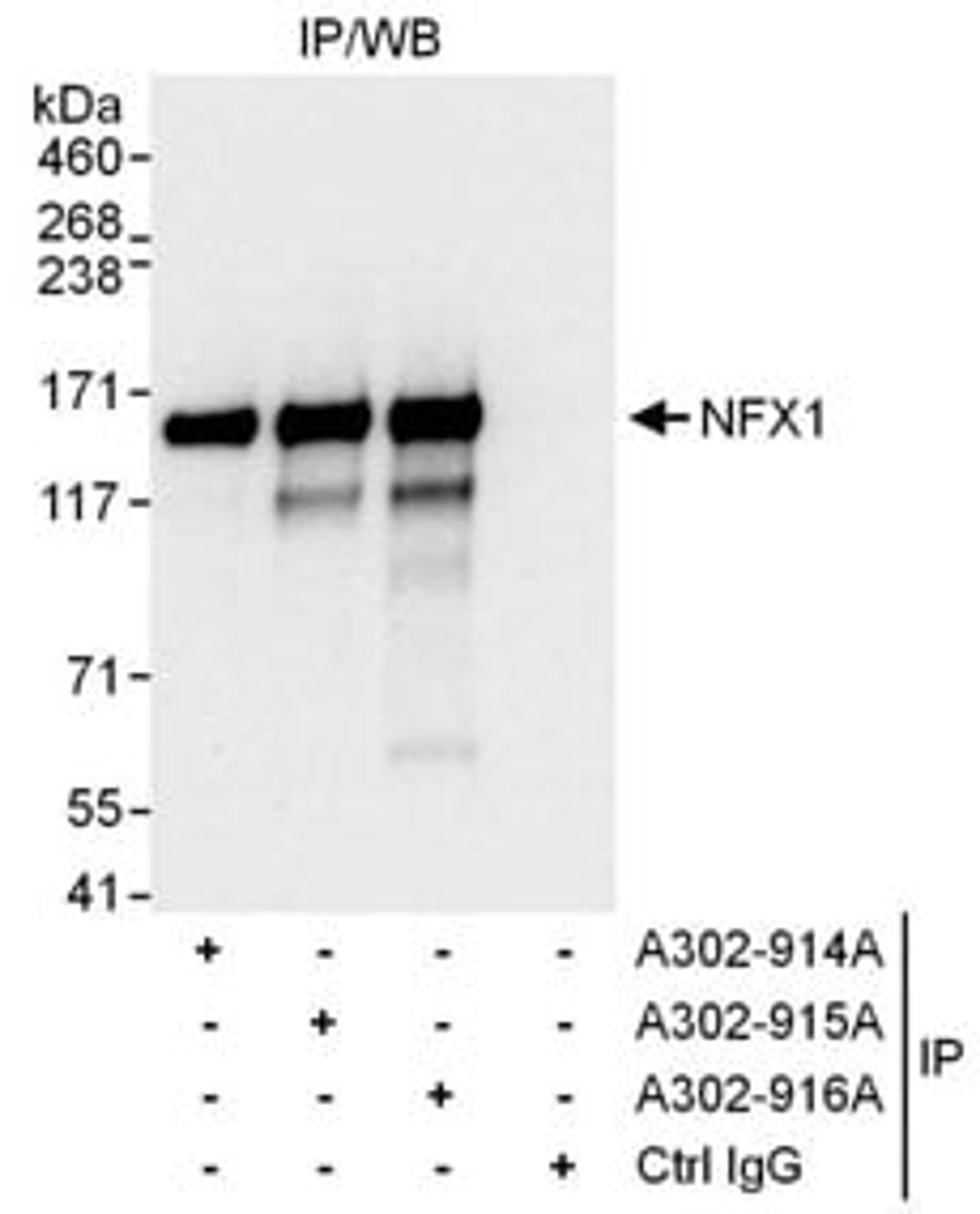 Detection of human NFX1 by western blot of immunoprecipitates.