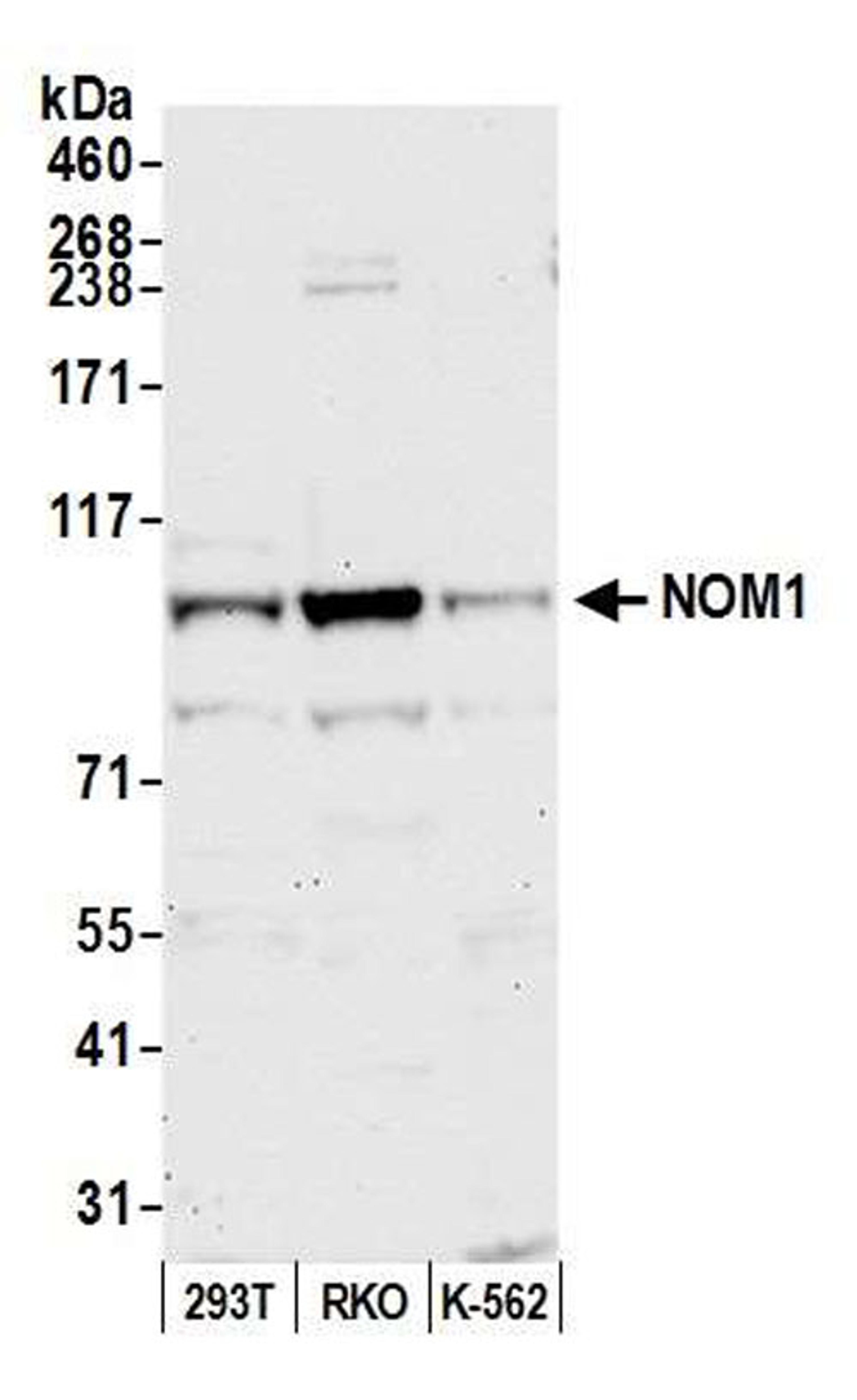 Detection of human NOM1 by WB.