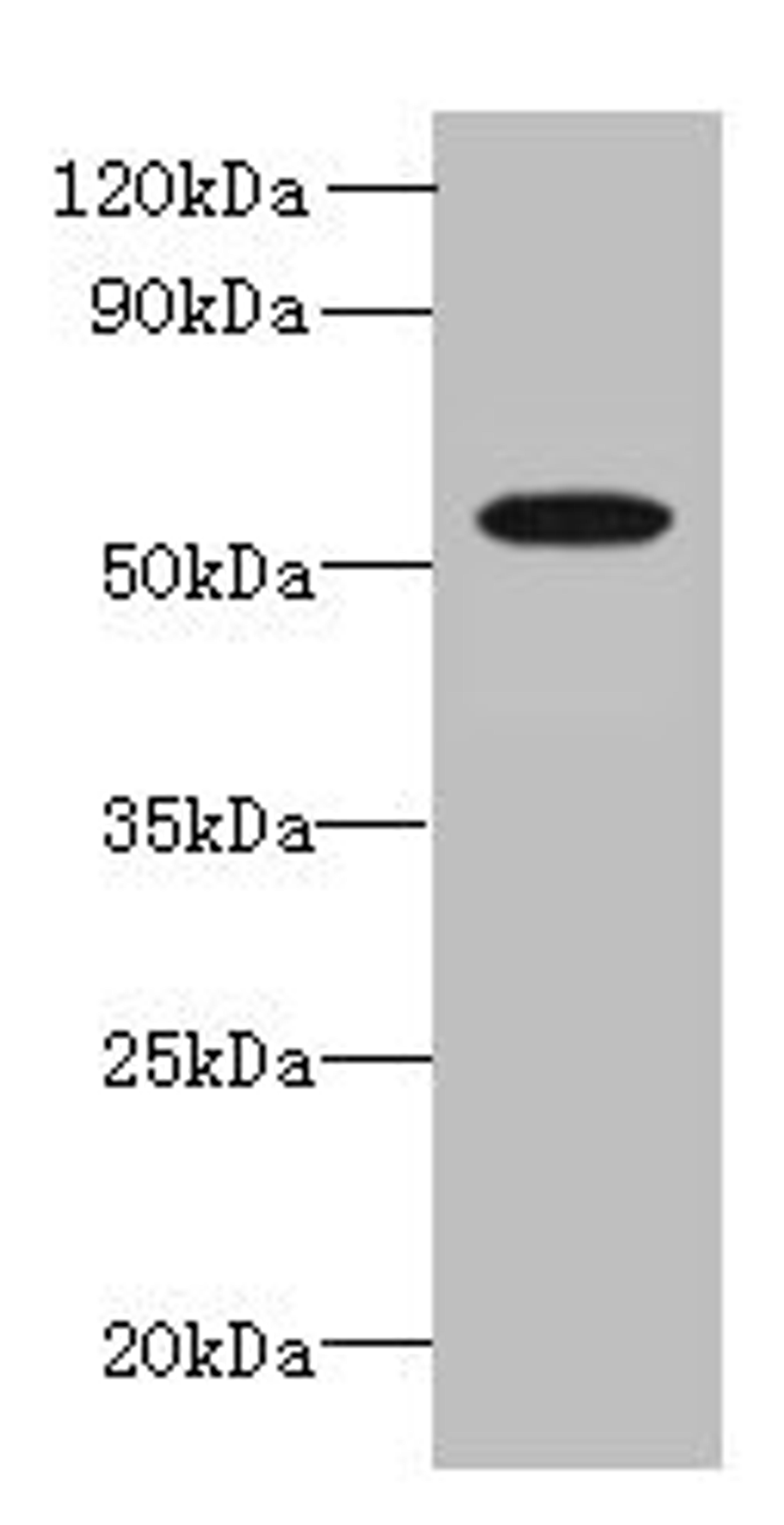 Western blot. All lanes: L2HGDH antibody at 8µg/ml + K562 whole cell lysate. Secondary. Goat polyclonal to rabbit IgG at 1/10000 dilution. Predicted band size: 51, 49 kDa. Observed band size: 51 kDa
