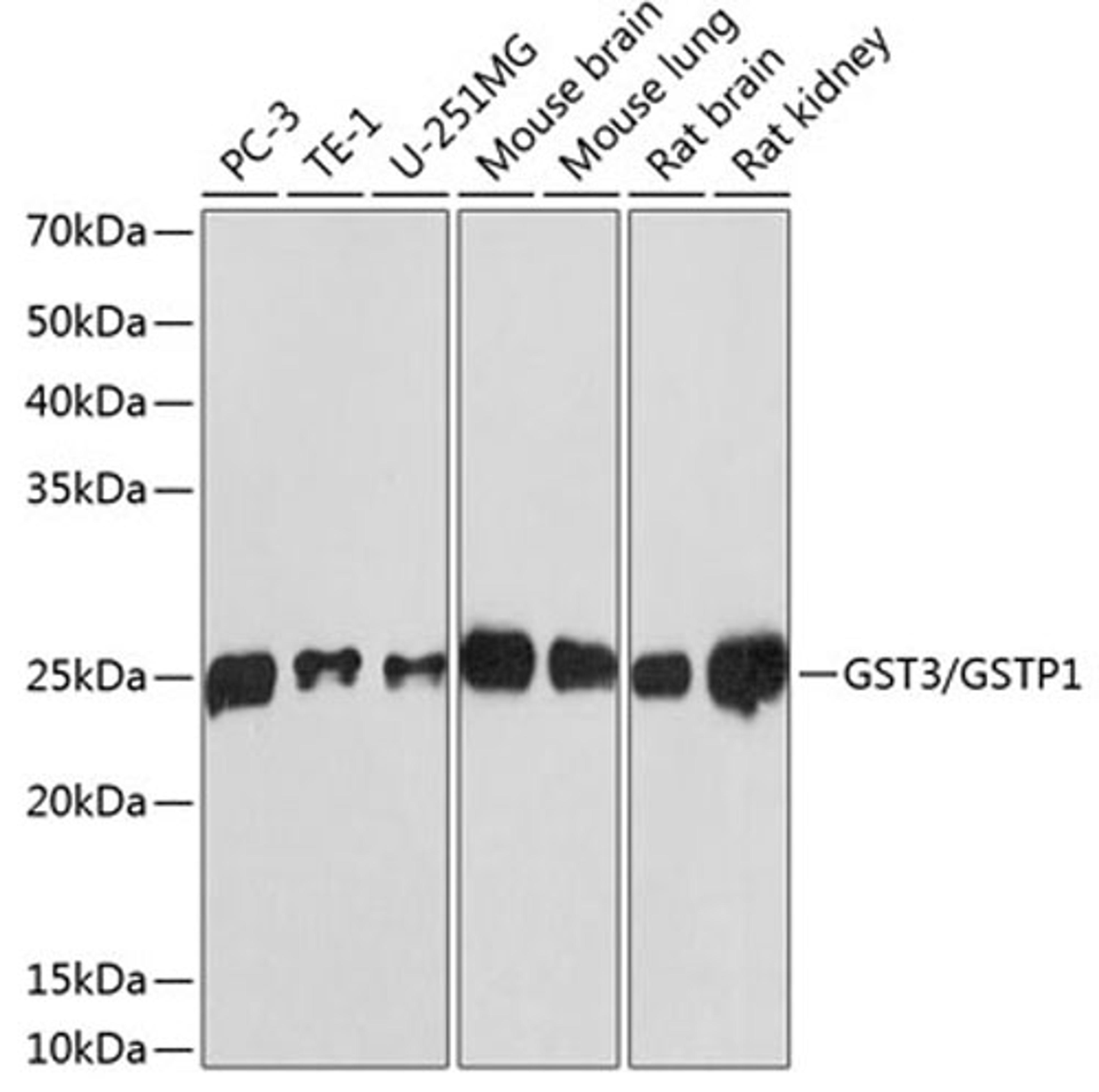 Western blot - GST3 / GSTP1 antibody (A19061)