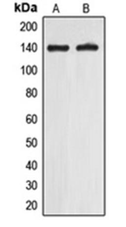 Western blot analysis of A549 (Lane 1), Jurkat (Lane 2) whole cell lysates using EIF5B antibody