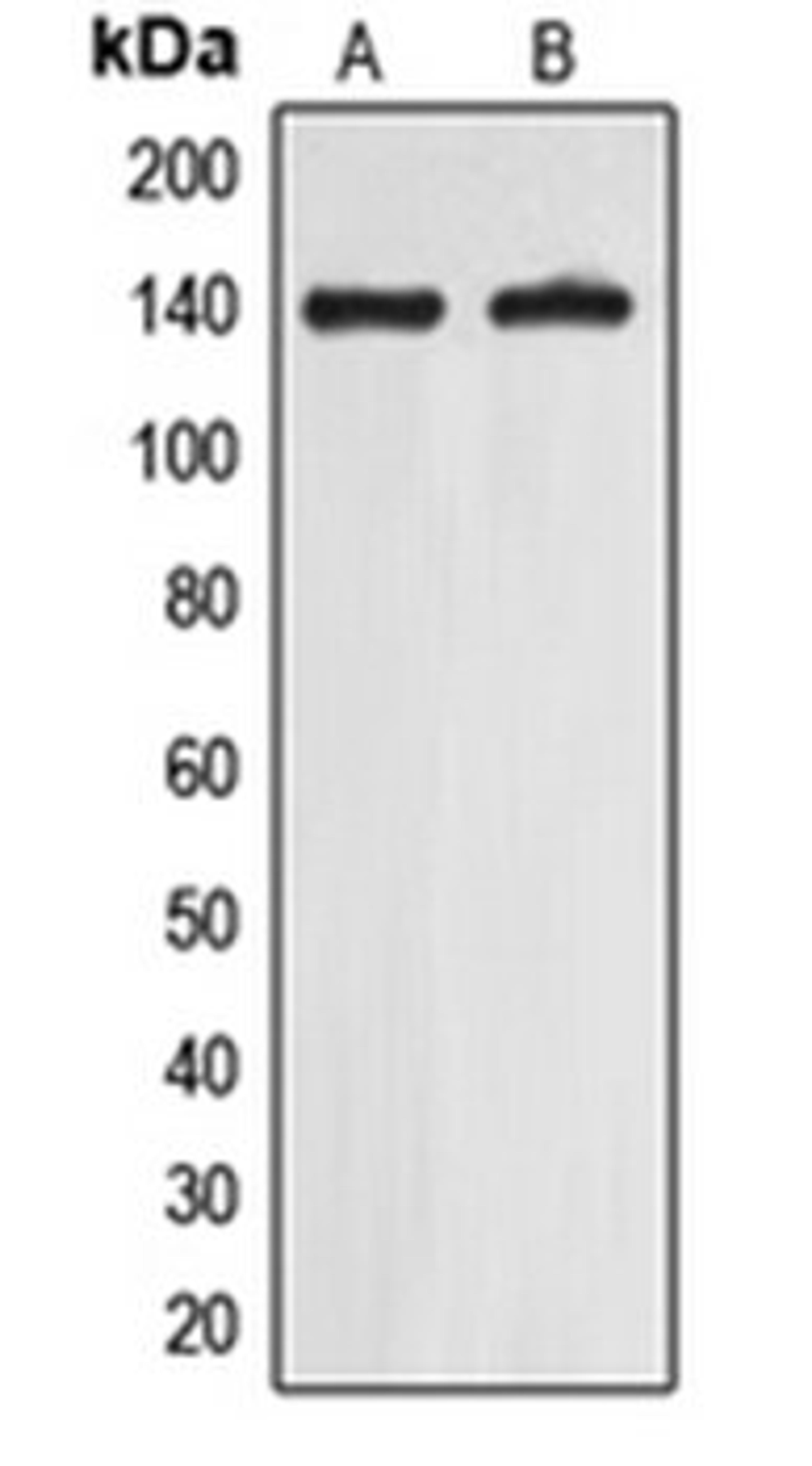 Western blot analysis of A549 (Lane 1), Jurkat (Lane 2) whole cell lysates using EIF5B antibody