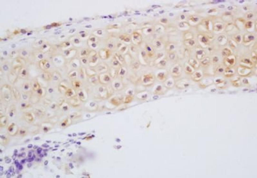 Immunohistochemical analysis of formalin-fixed paraffin embedded Rat heart tissue using DSPP antibody (dilution at 1:200)