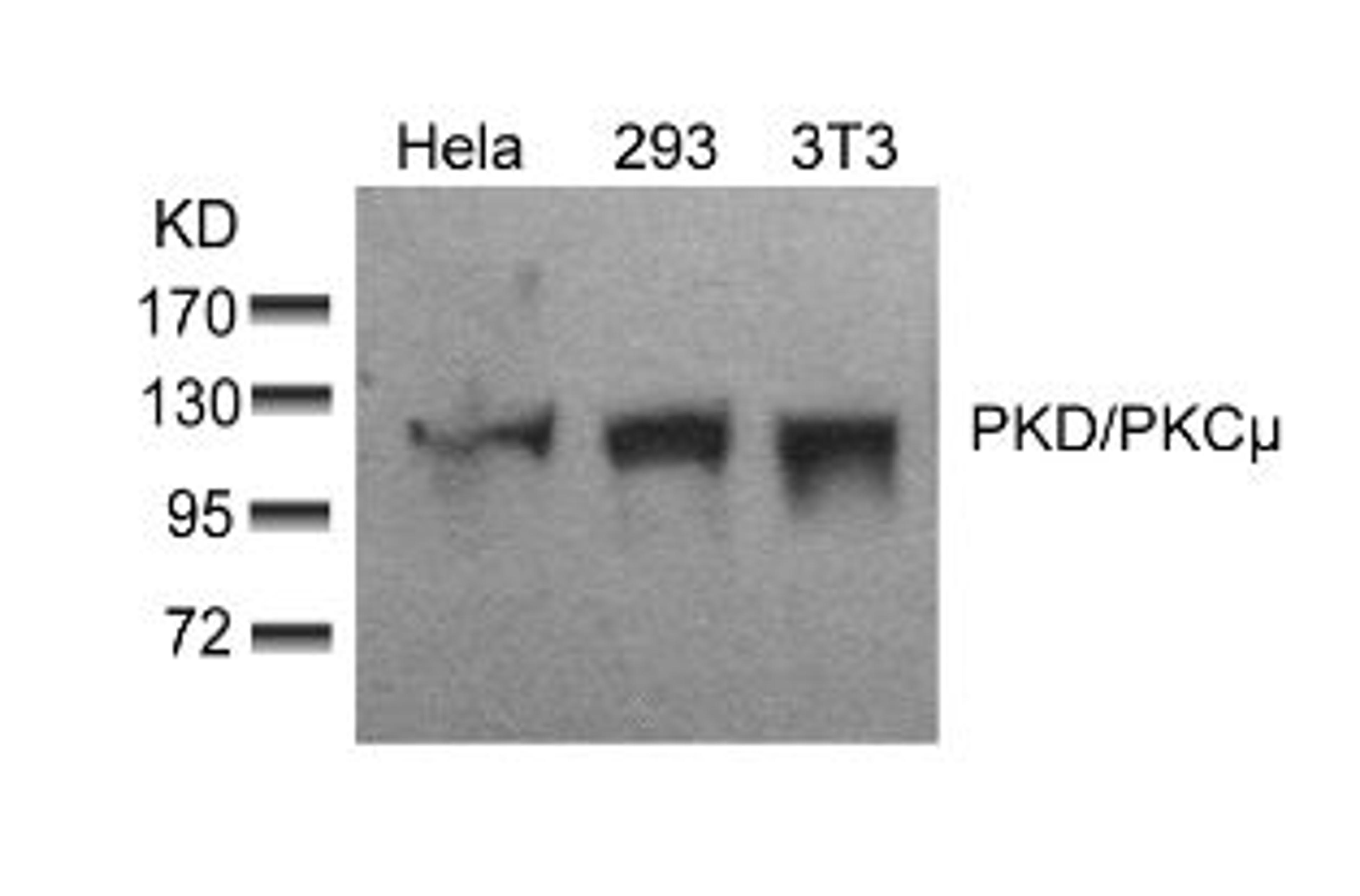 Western blot analysis of lysed extracts from HeLa, 293 and 3T3 cells using PKD/PKCμ (Ab-910).