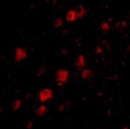 Immunocytochemistry/Immunofluorescence: POLR3F Antibody [NBP1-76929] - Immunofluorescence of POLR3F in human brain tissue with POLR3F antibody at 20 ug/mL.