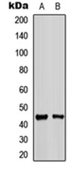 Western blot analysis of HeLa (Lane1), NIH3T3 (Lane2) whole cell using Kir6.2 antibody