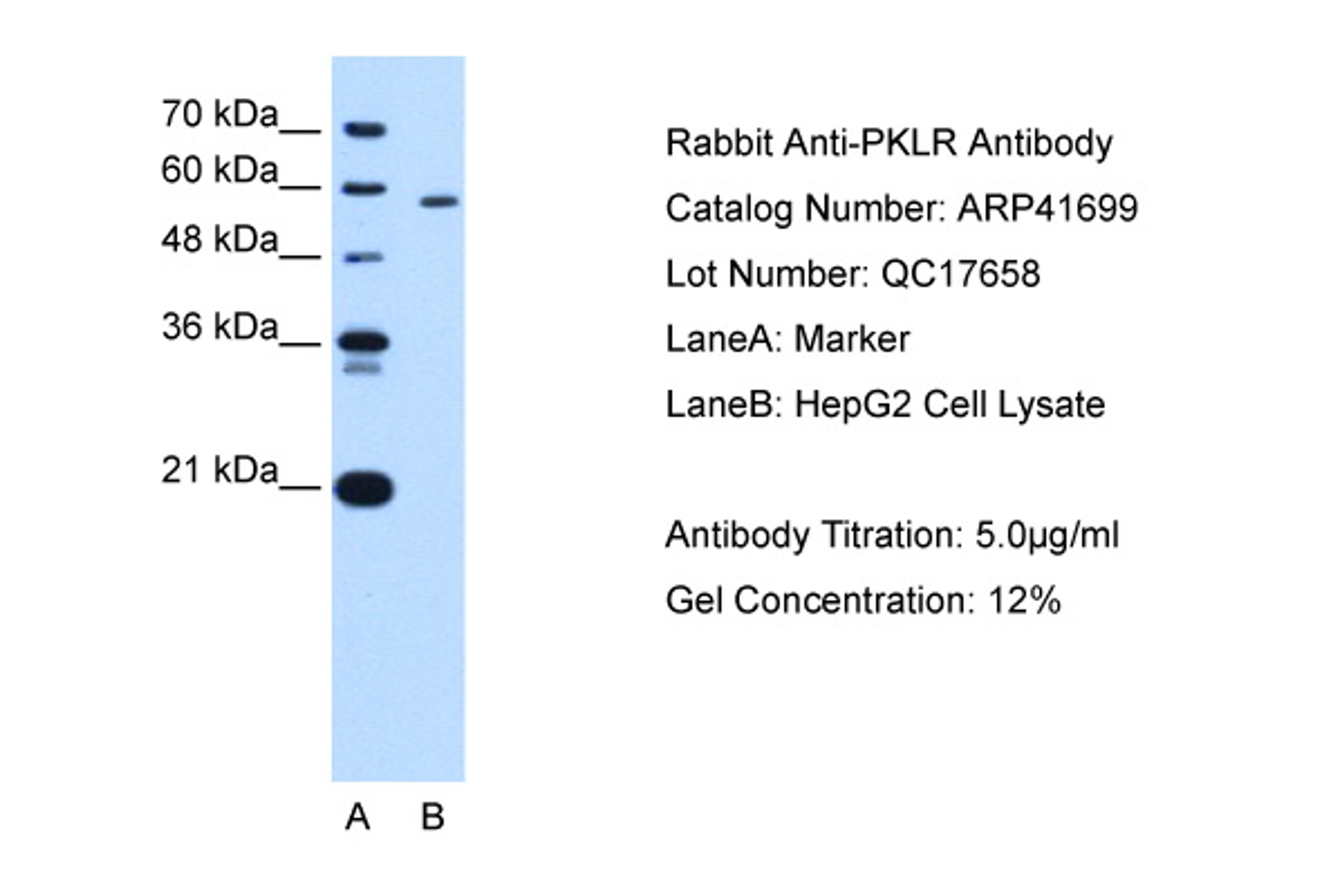 Antibody used in WB on Human HepG2 at 1 ug/ml.