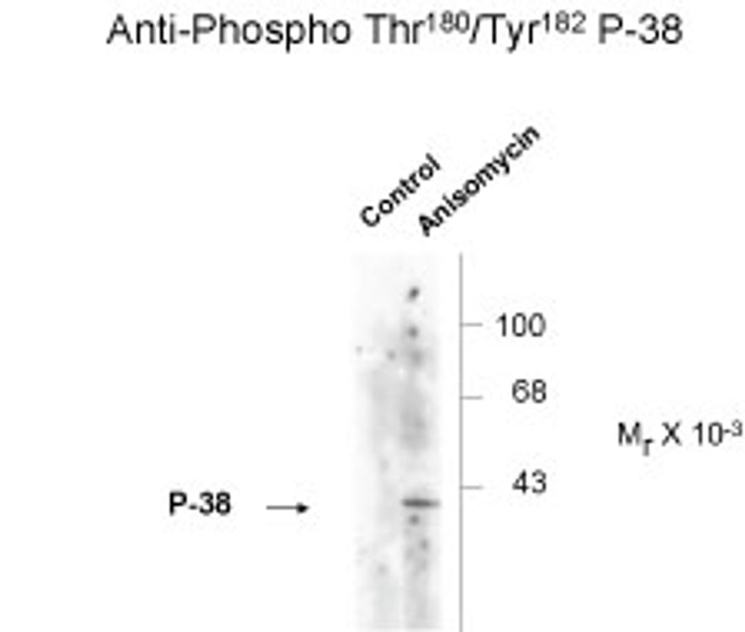 Western blot of Hela cell lysates that had been treated with +/- UV(30 min.) showing phosphospecific immunolabeling of the ~39k p38 MAPK protein phosphorylated at Thr180 and Tyr182.