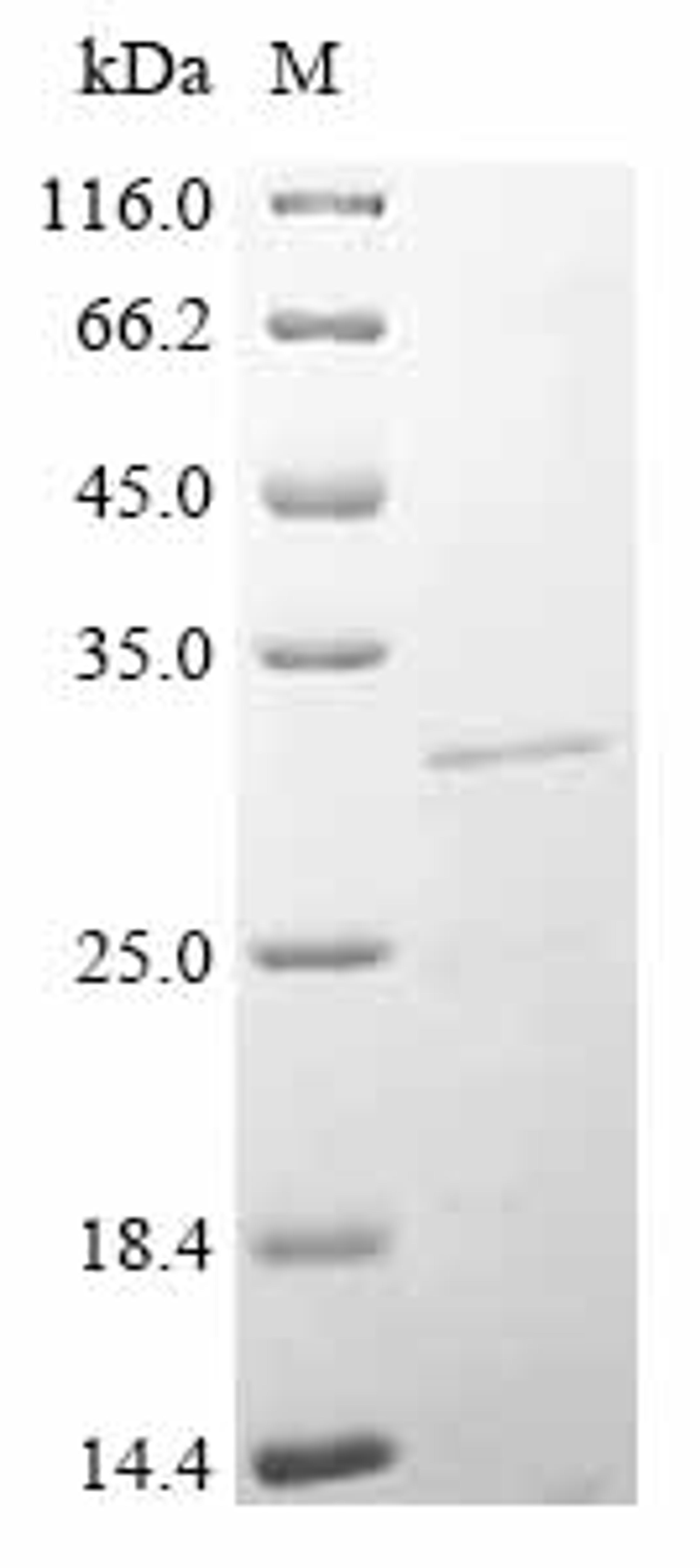 (Tris-Glycine gel) Discontinuous SDS-PAGE (reduced) with 5% enrichment gel and 15% separation gel.
