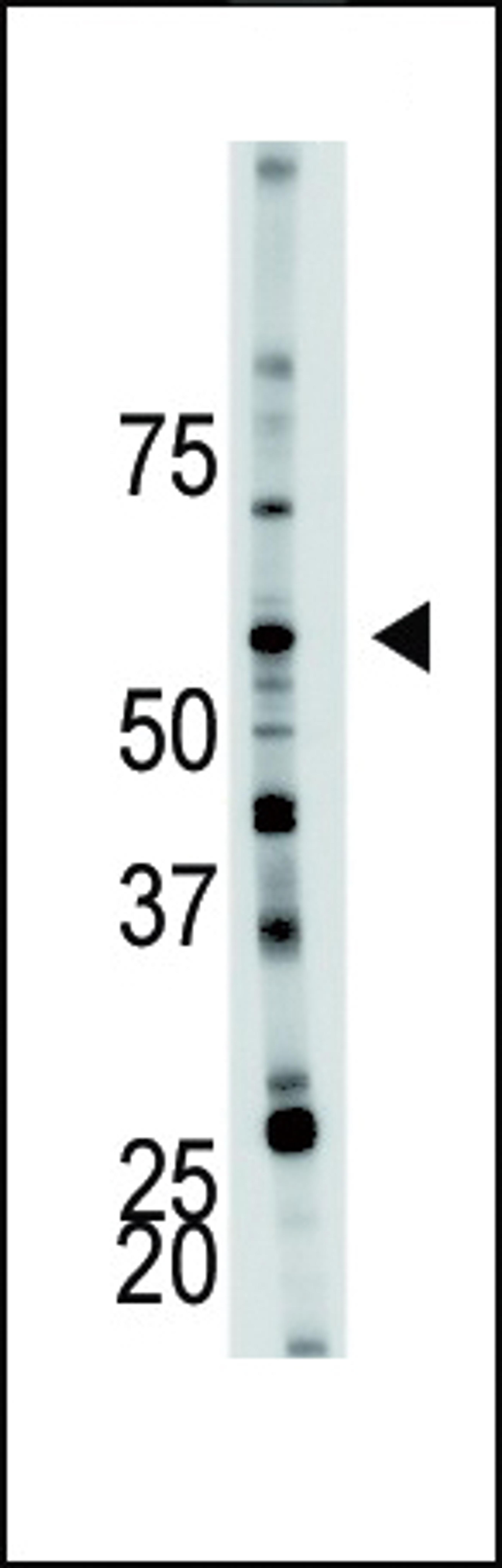 Antibody is used in Western blot to detect PFKFB4 in mouse brain tissue lysate.