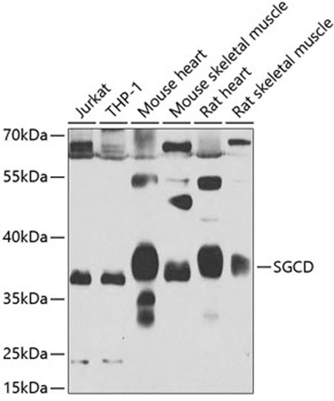 Western blot - SGCD antibody (A6980)