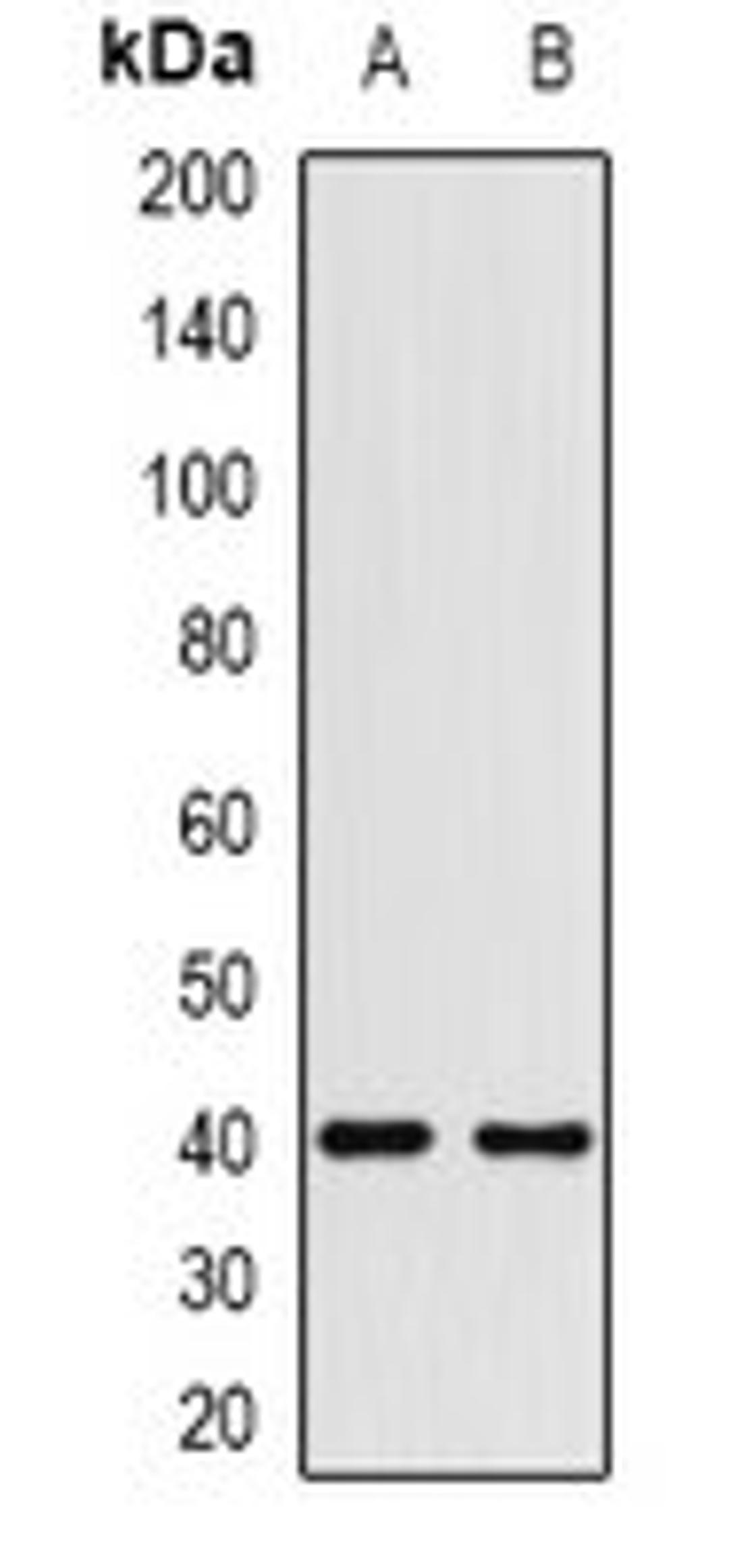 Western blot analysis of HEK293T (Lane1), Hela (Lane2) whole cell lysates using HMG20A antibody