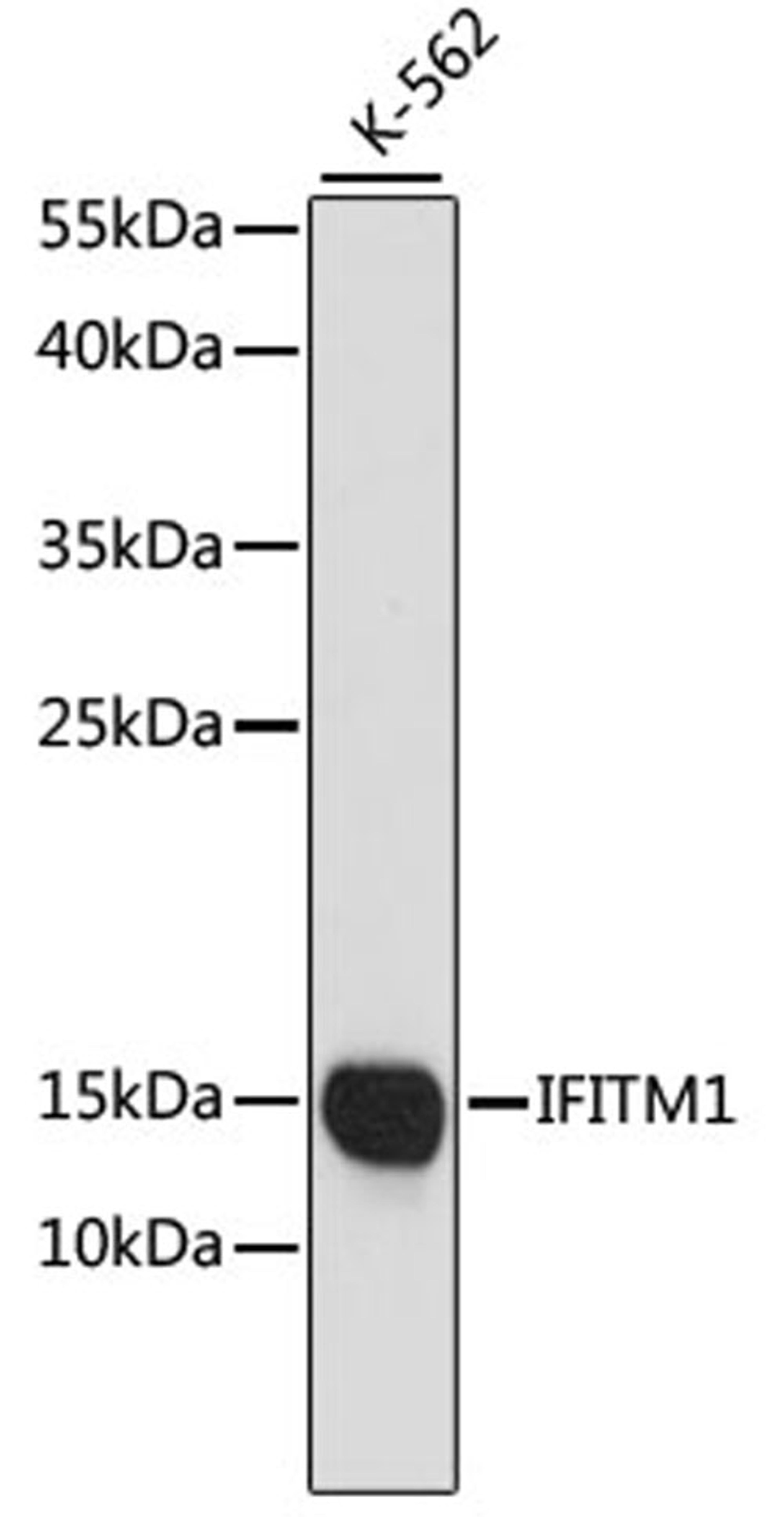 Western blot - IFITM1 antibody (A4228)