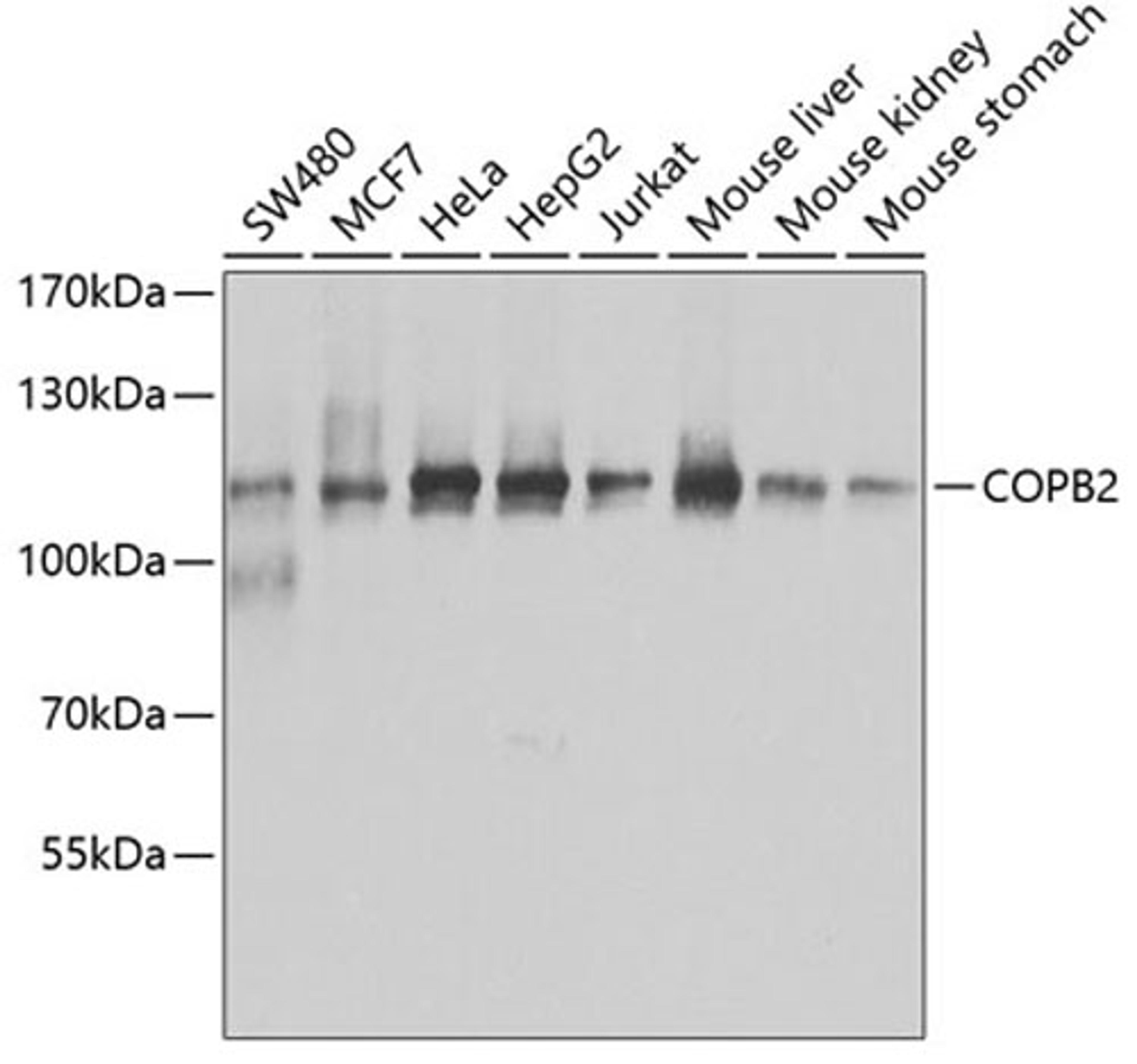 Western blot - COPB2 antibody (A7036)