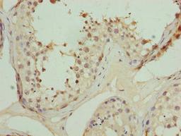Immunohistochemistry of paraffin-embedded human testis tissue using CSB-PA623008LA01HU at dilution of 1:100