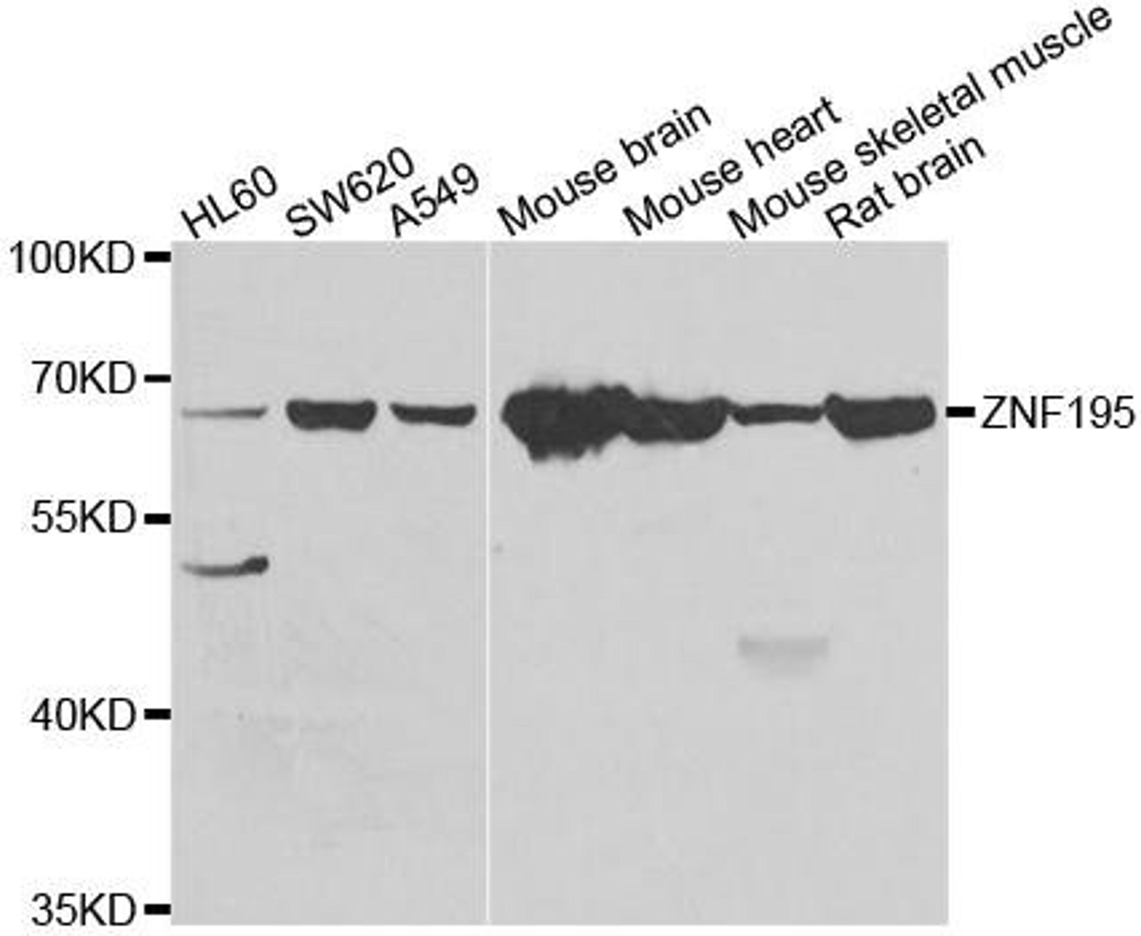 Western blot analysis of extracts of various cell lines using ZNF195 antibody