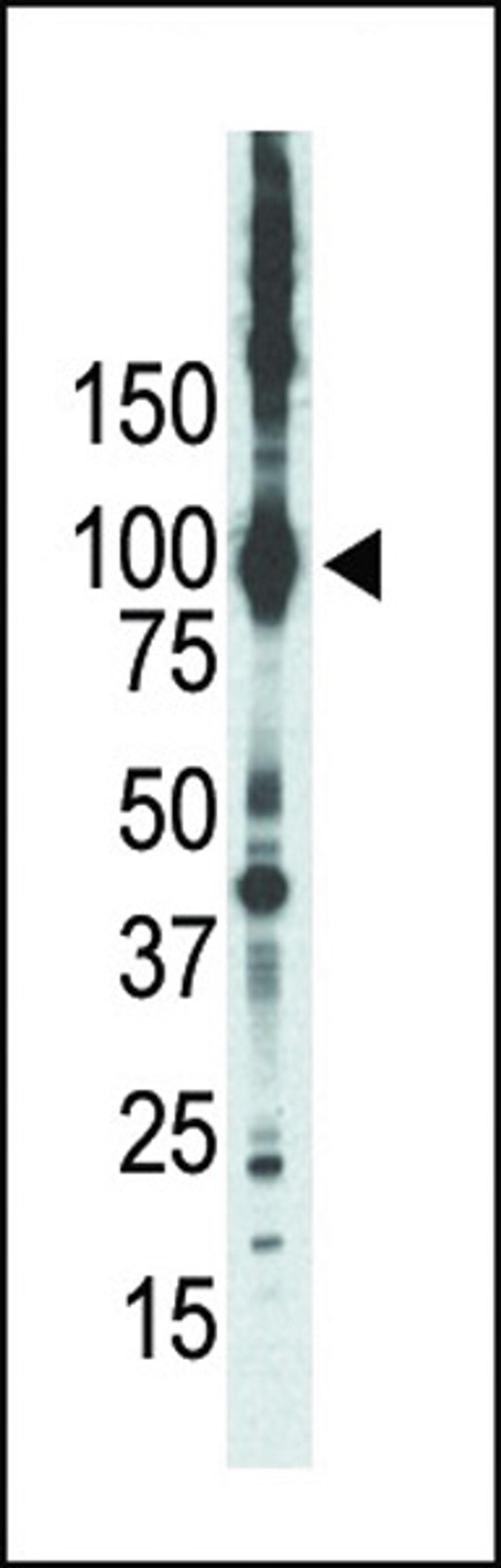 Western blot analysis of anti-PKCepsilon Pab in placenta lysate. PKCepsilon was detected using purified Pab.