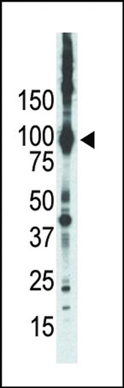 Western blot analysis of anti-PKCepsilon Pab in placenta lysate. PKCepsilon was detected using purified Pab.