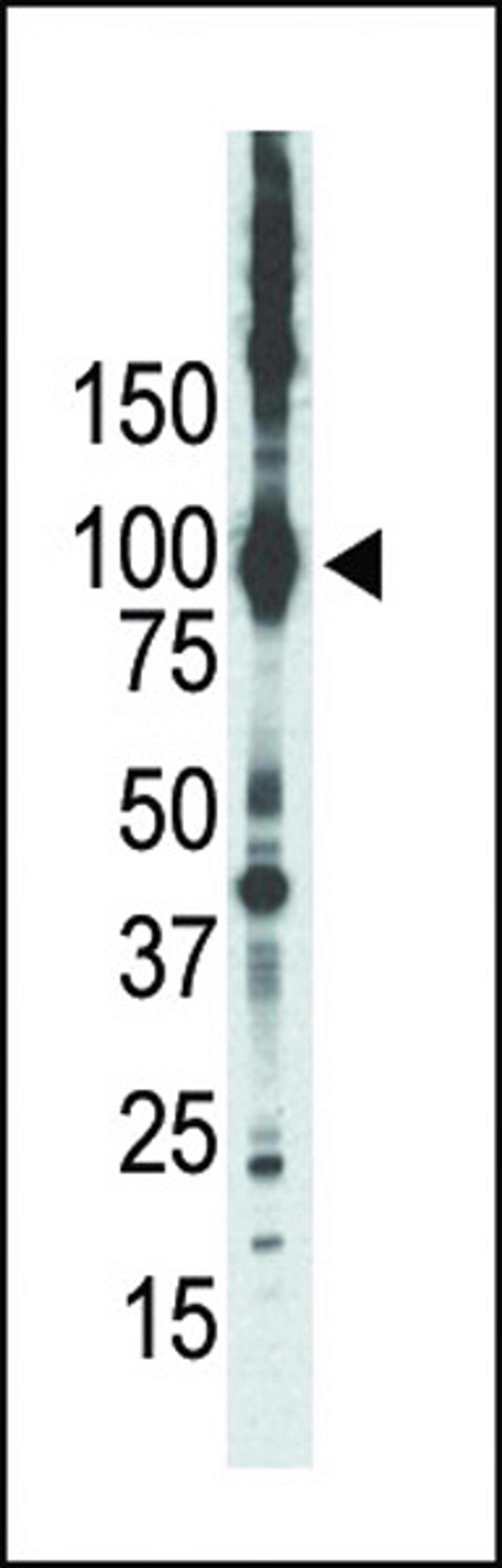 Western blot analysis of anti-PKCepsilon Pab in placenta lysate. PKCepsilon was detected using purified Pab.