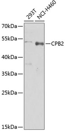 Western blot - CPB2 Antibody (A5634)