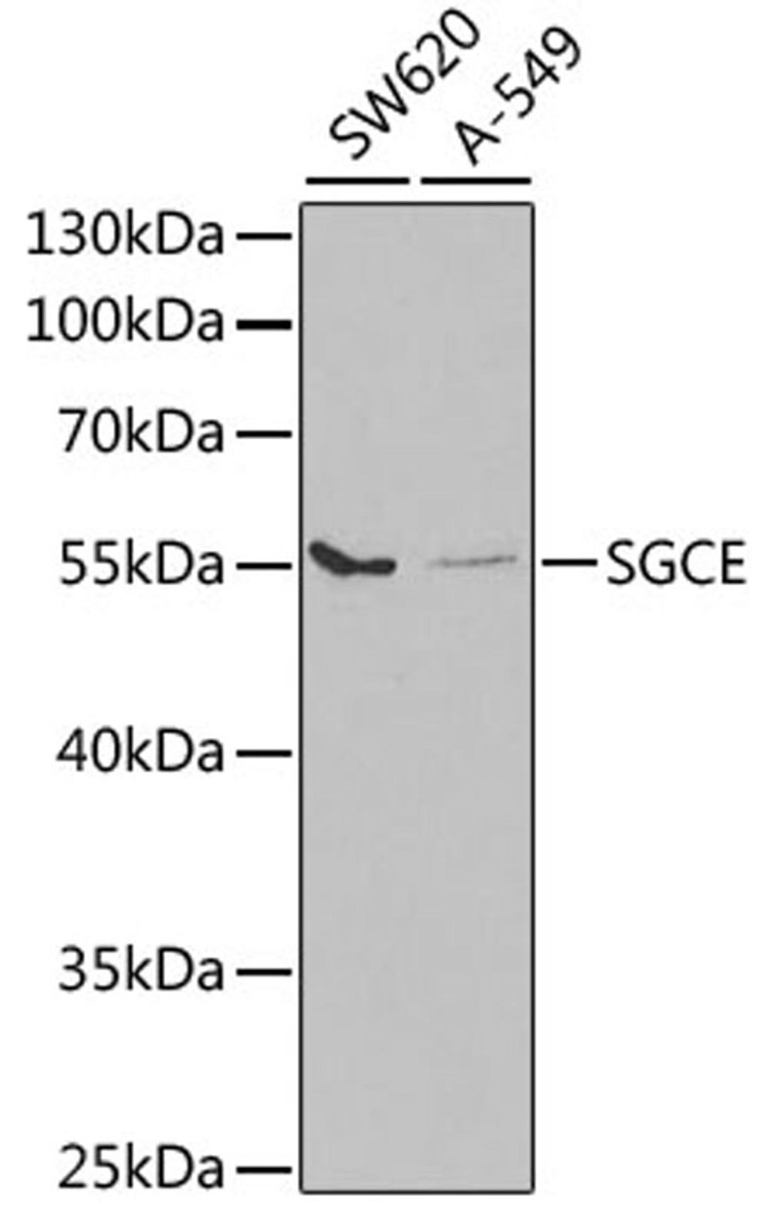 Western blot - SGCE antibody (A5330)