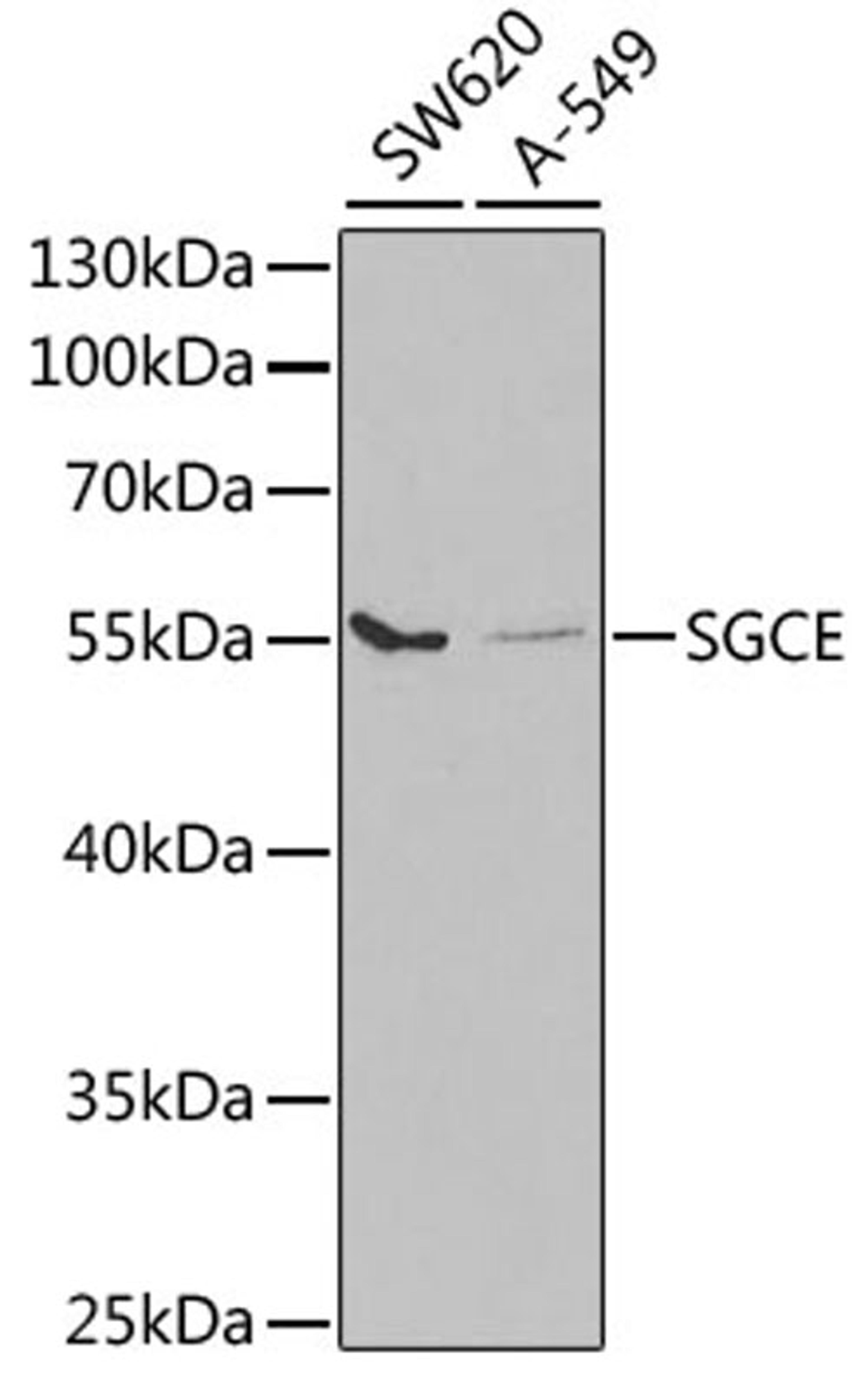 Western blot - SGCE antibody (A5330)