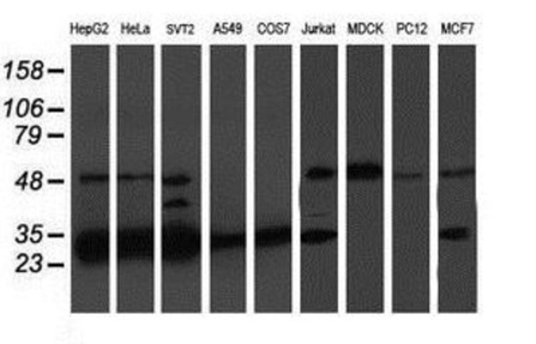 Western Blot: Proteasome 20S beta 7 Antibody (1E1) [NBP2-01832] Analysis of extracts (35ug) from 9 different cell lines by using anti-Proteasome 20S beta 7 monoclonal antibody.